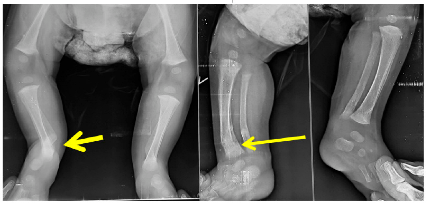 Children 10 00152 g006 Children 10 00152 g006