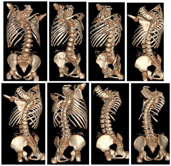 ribcage corset  Rib cage, Corset diy, Skull and bones