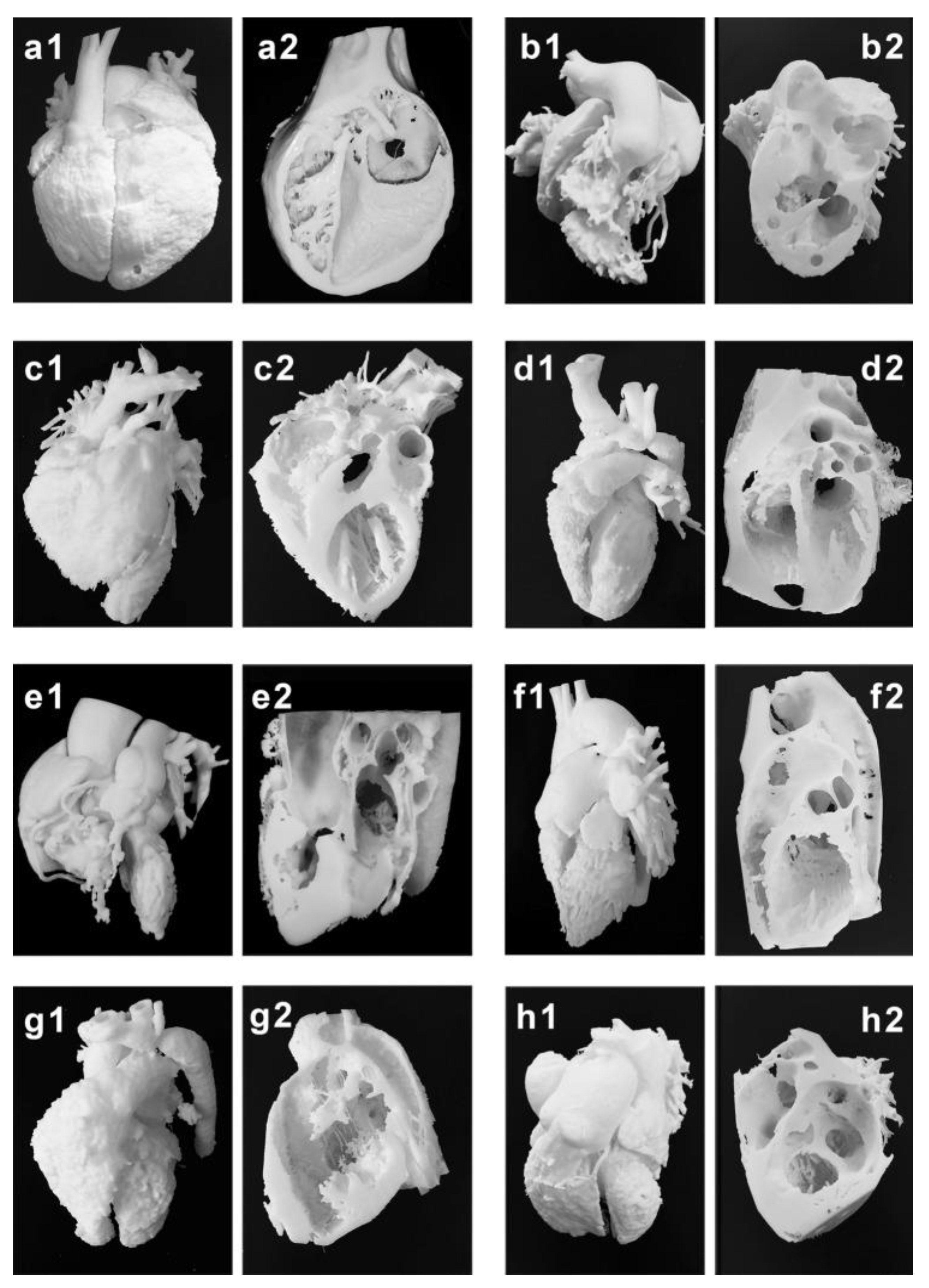 Children 10 00319 g003 Children 10 00319 g003