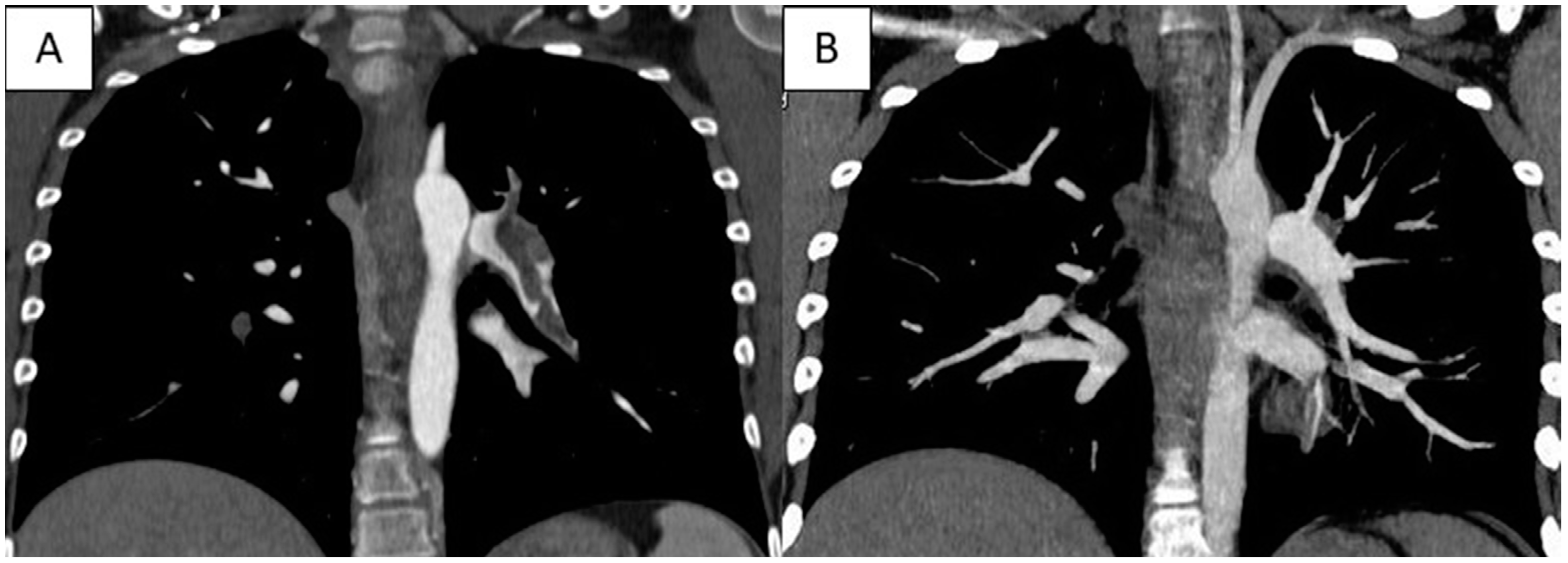 Children 10 00618 g001 Children 10 00618 g001