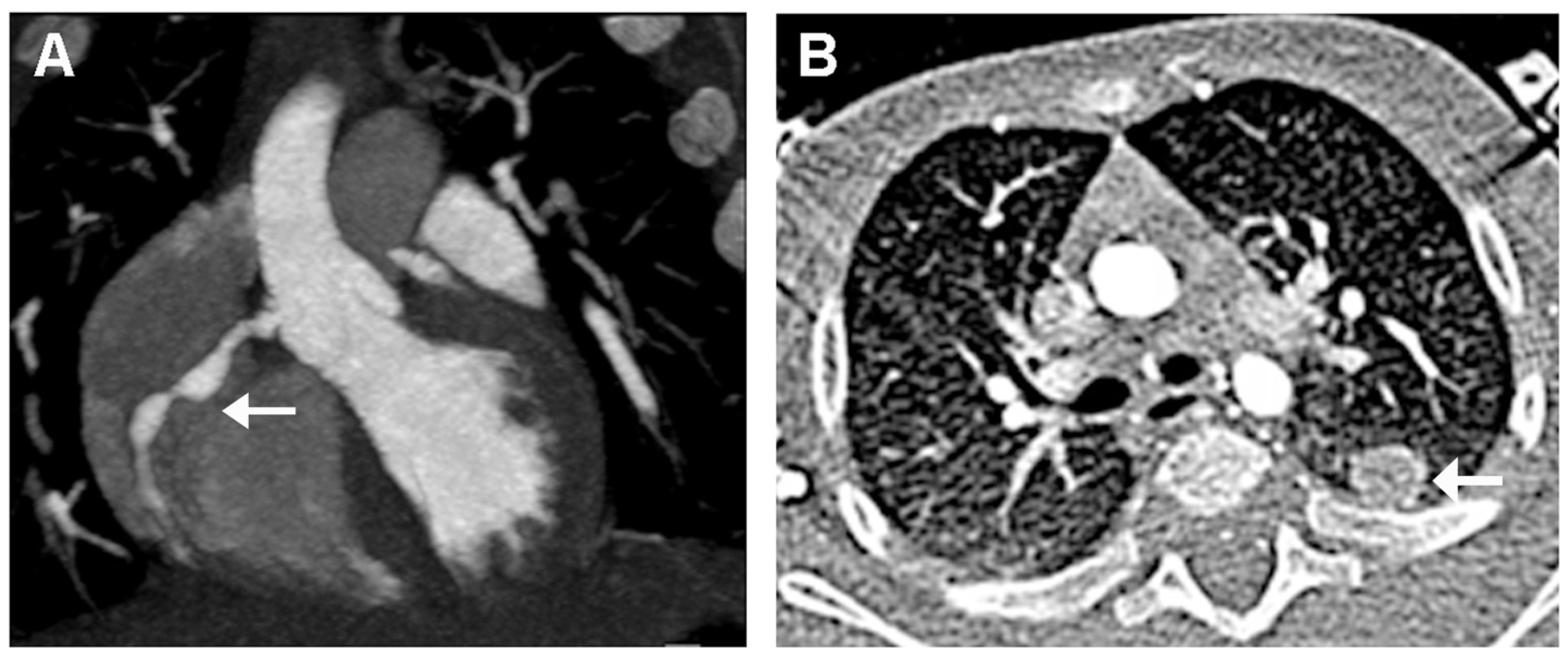 Children 10 00679 g004 Children 10 00679 g004