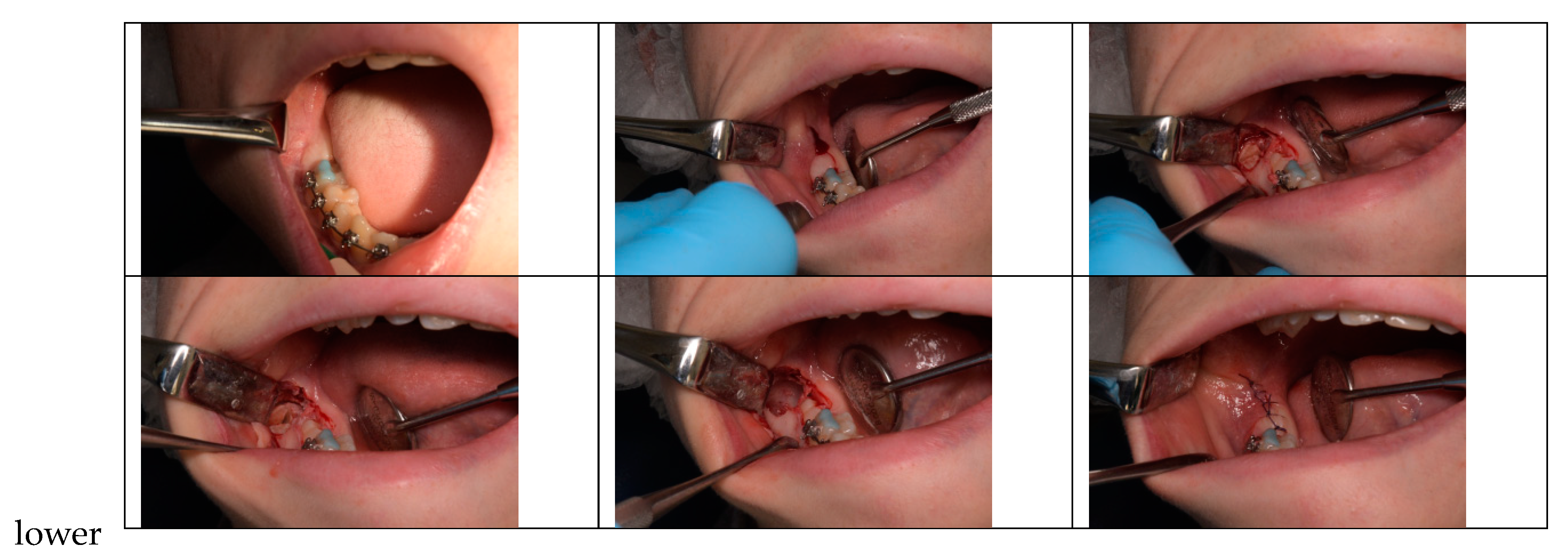 Children 10 01077 g001 Children 10 01077 g001