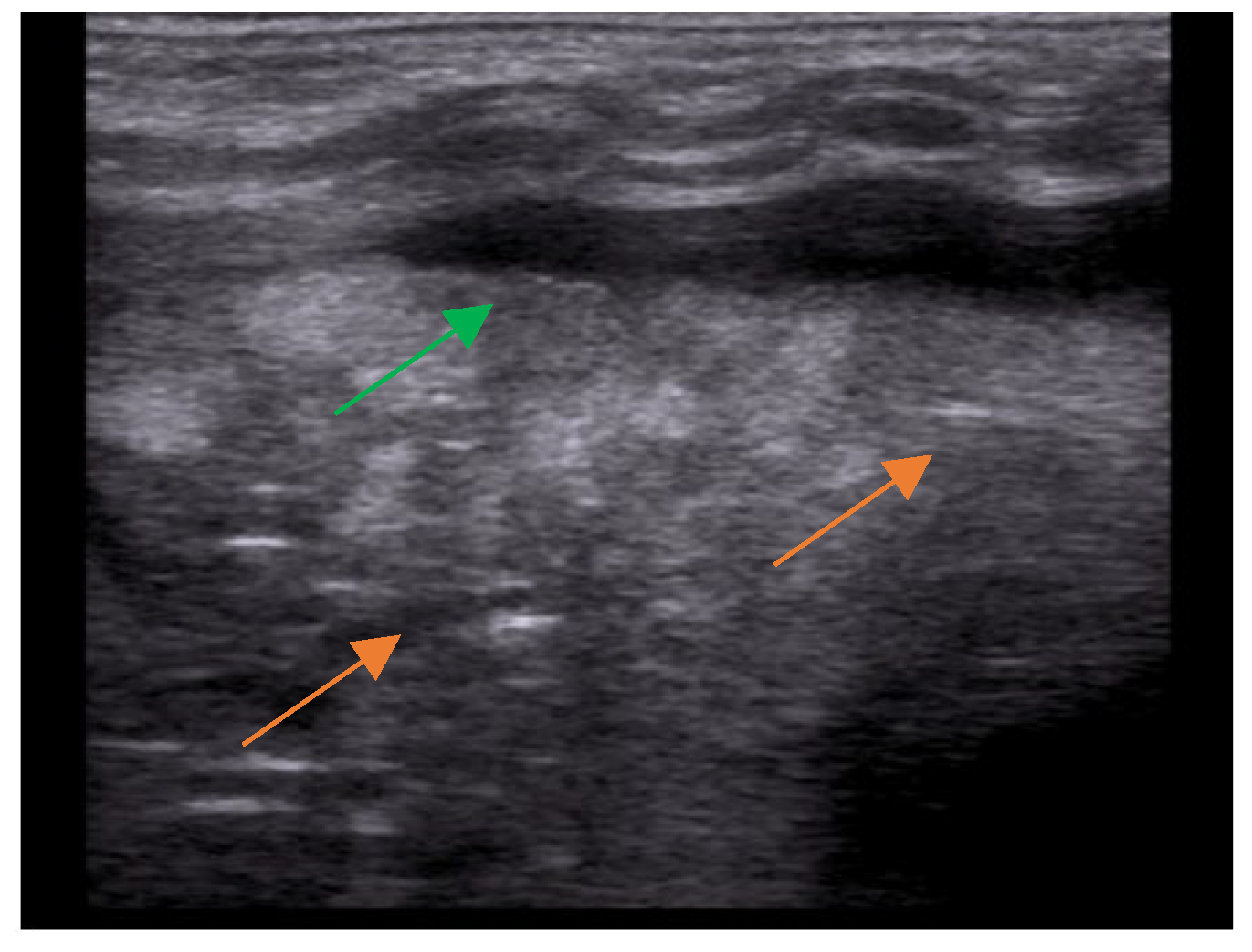 Children 10 01335 g003