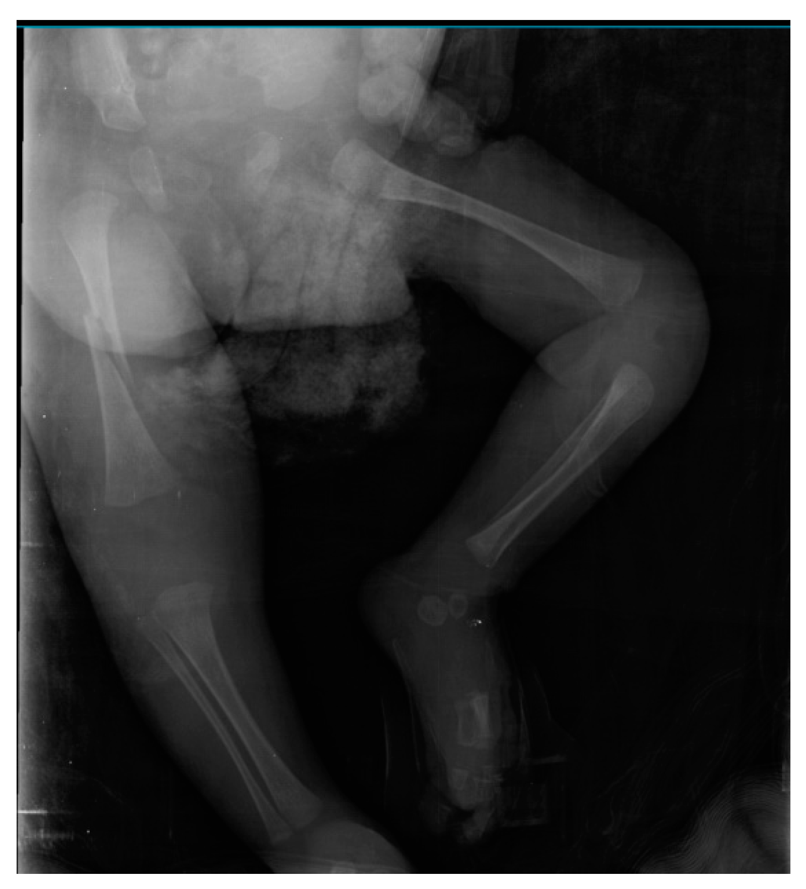 Children 10 01375 g004 Children 10 01375 g004