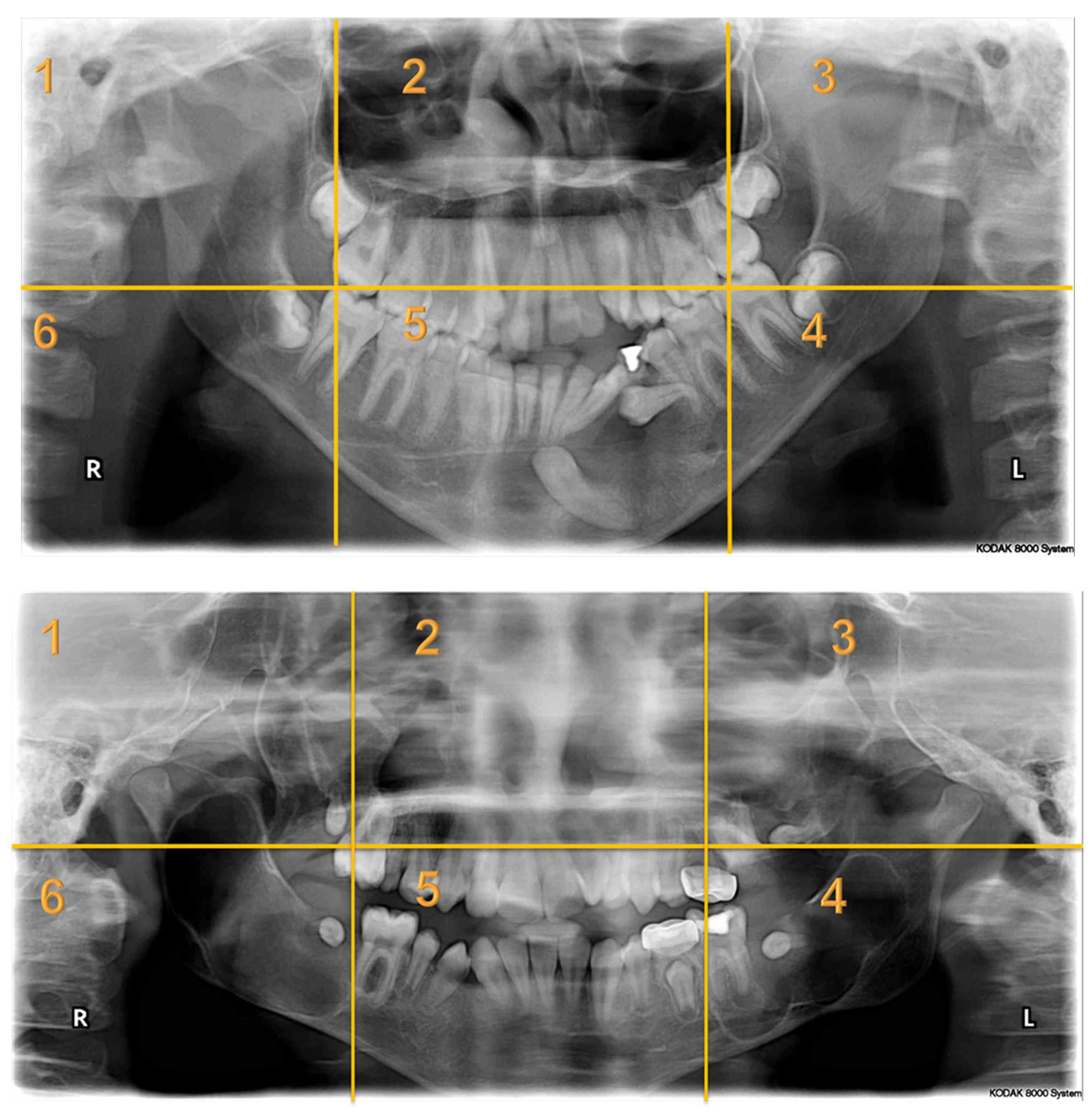 Children 10 01476 i001