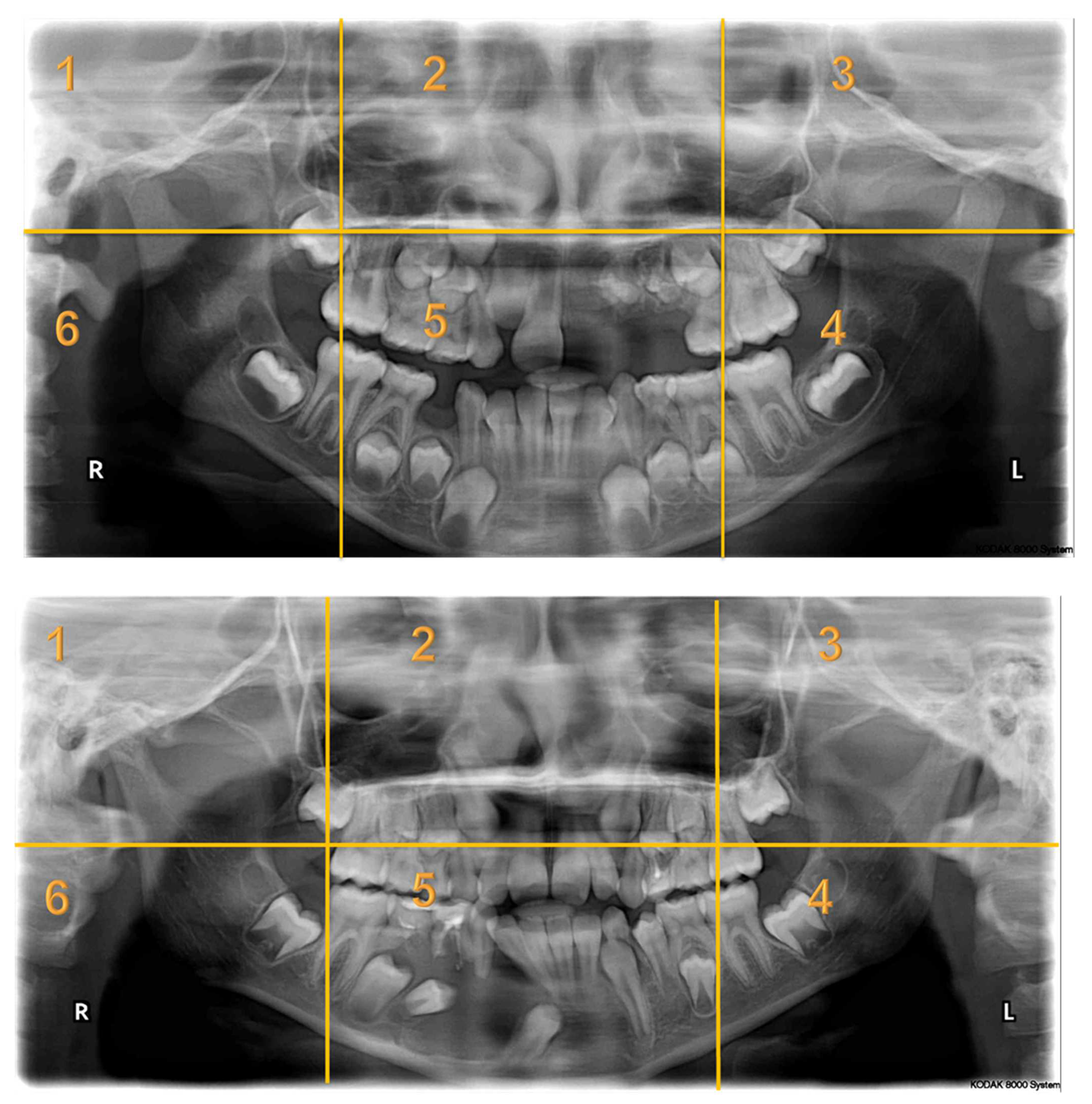 Children 10 01476 i002