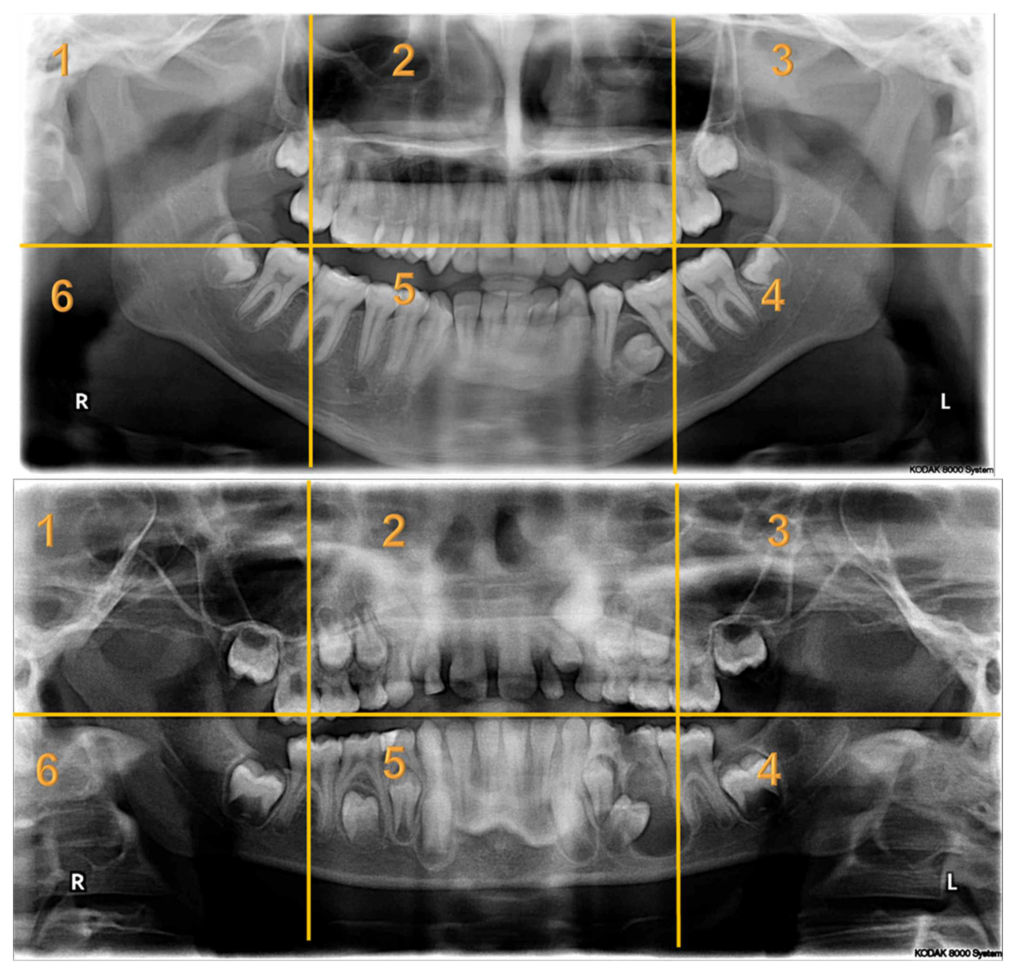 Children 10 01476 i003