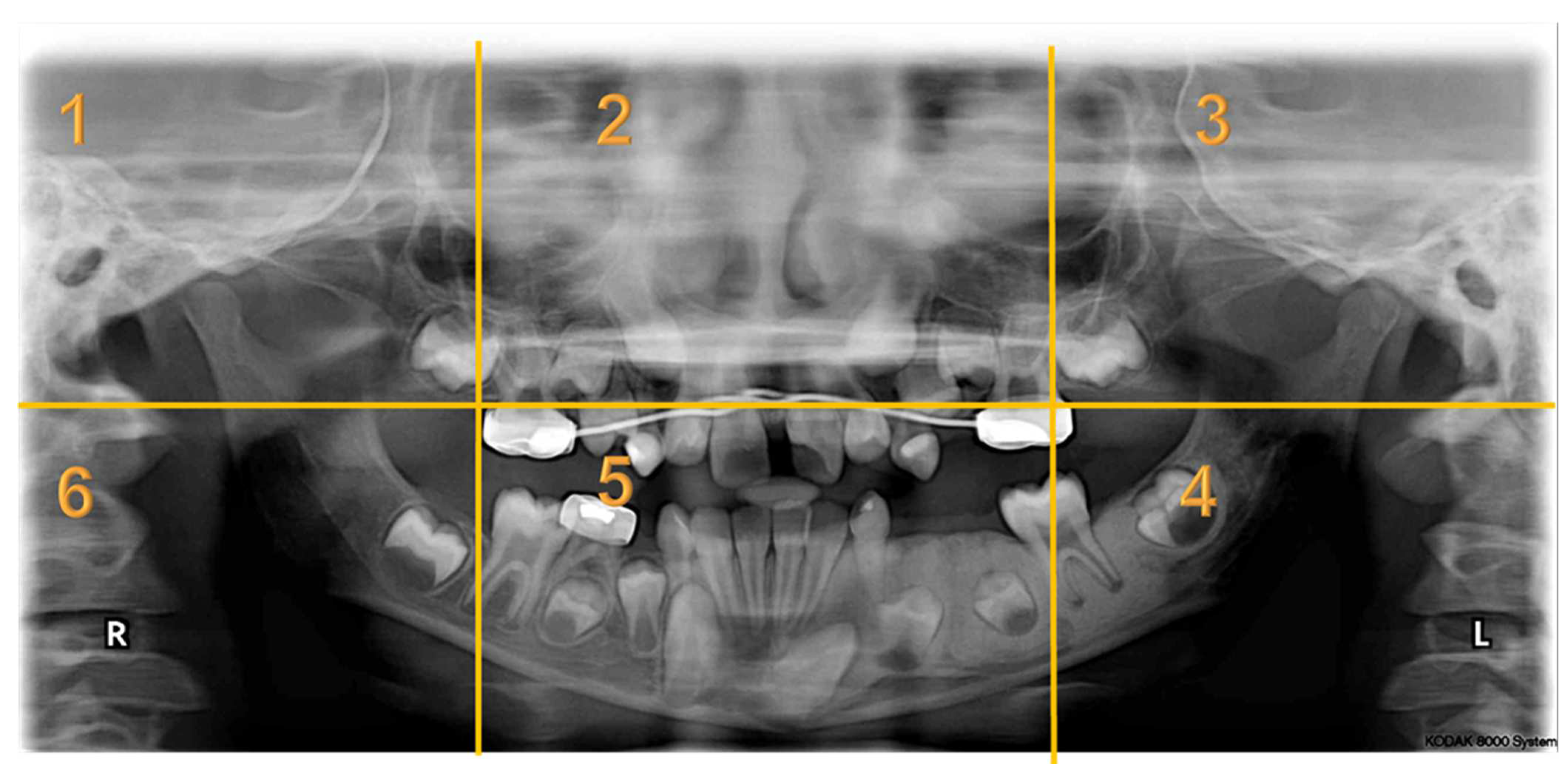 Children 10 01476 i004