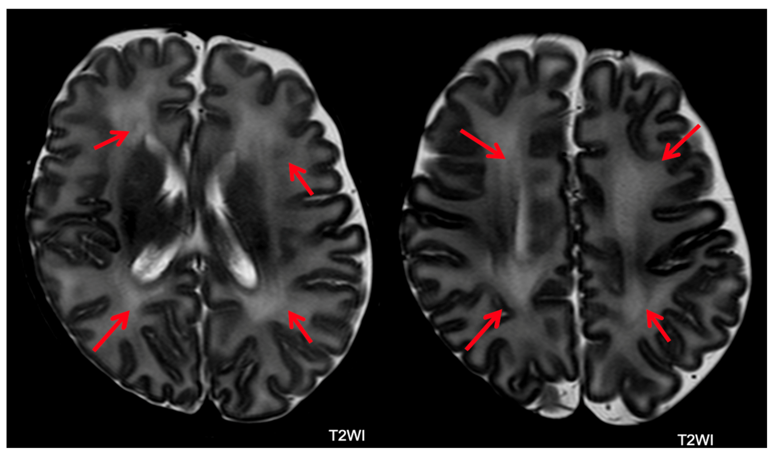 Children 11 00012 g009