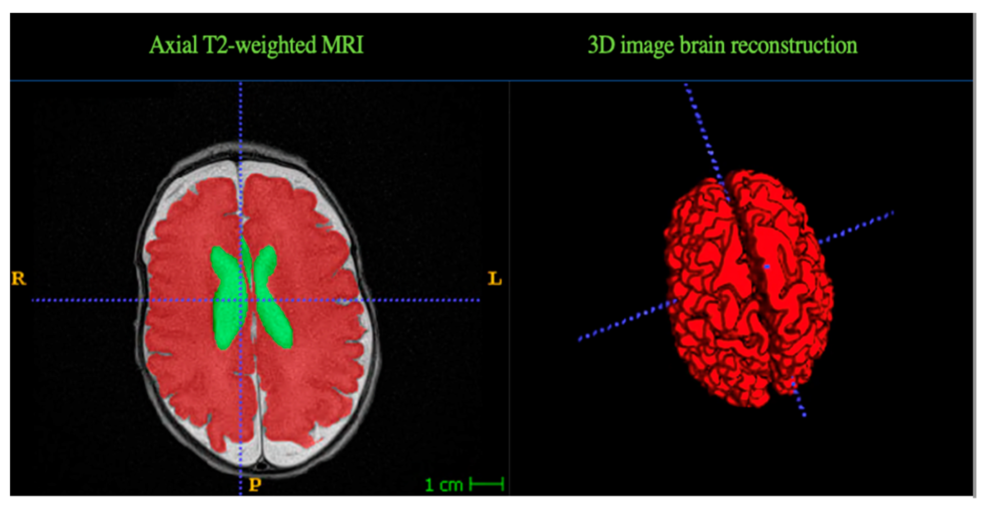 Children 11 00121 g001 Children 11 00121 g001
