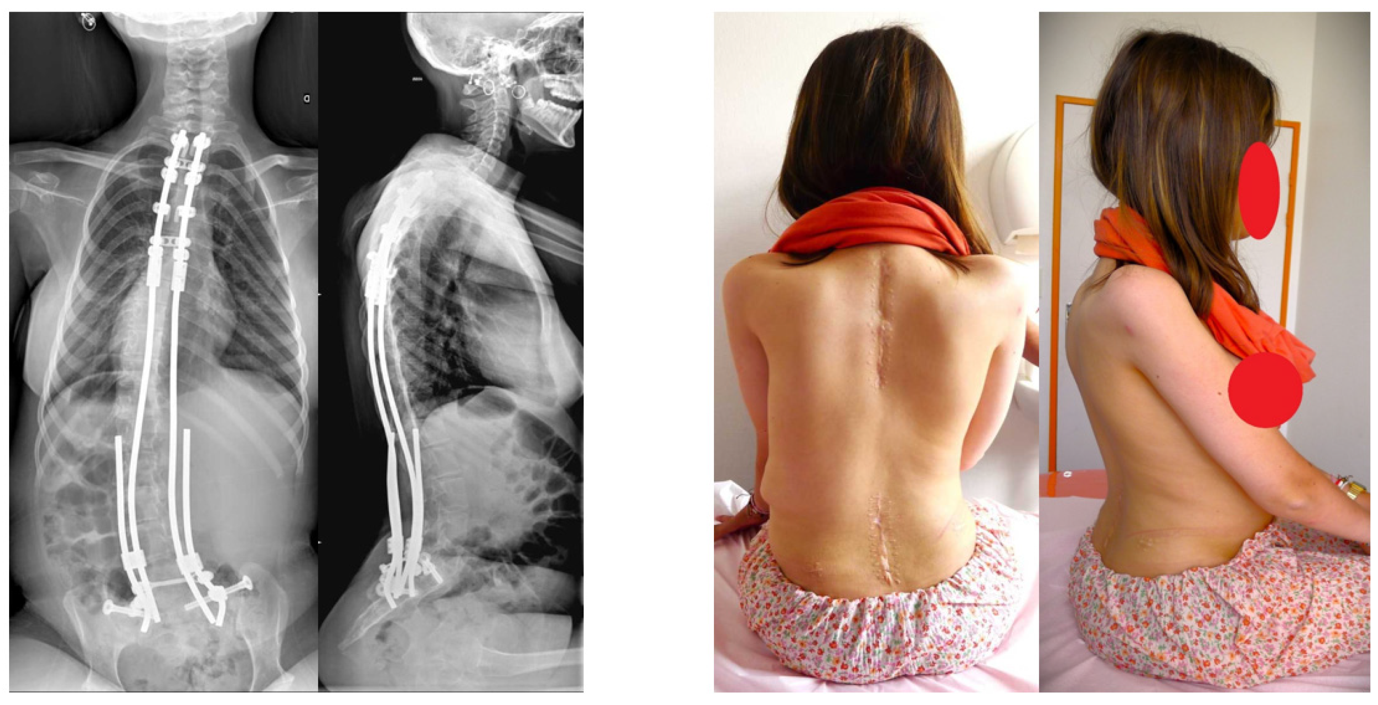 Children 11 00199 g003