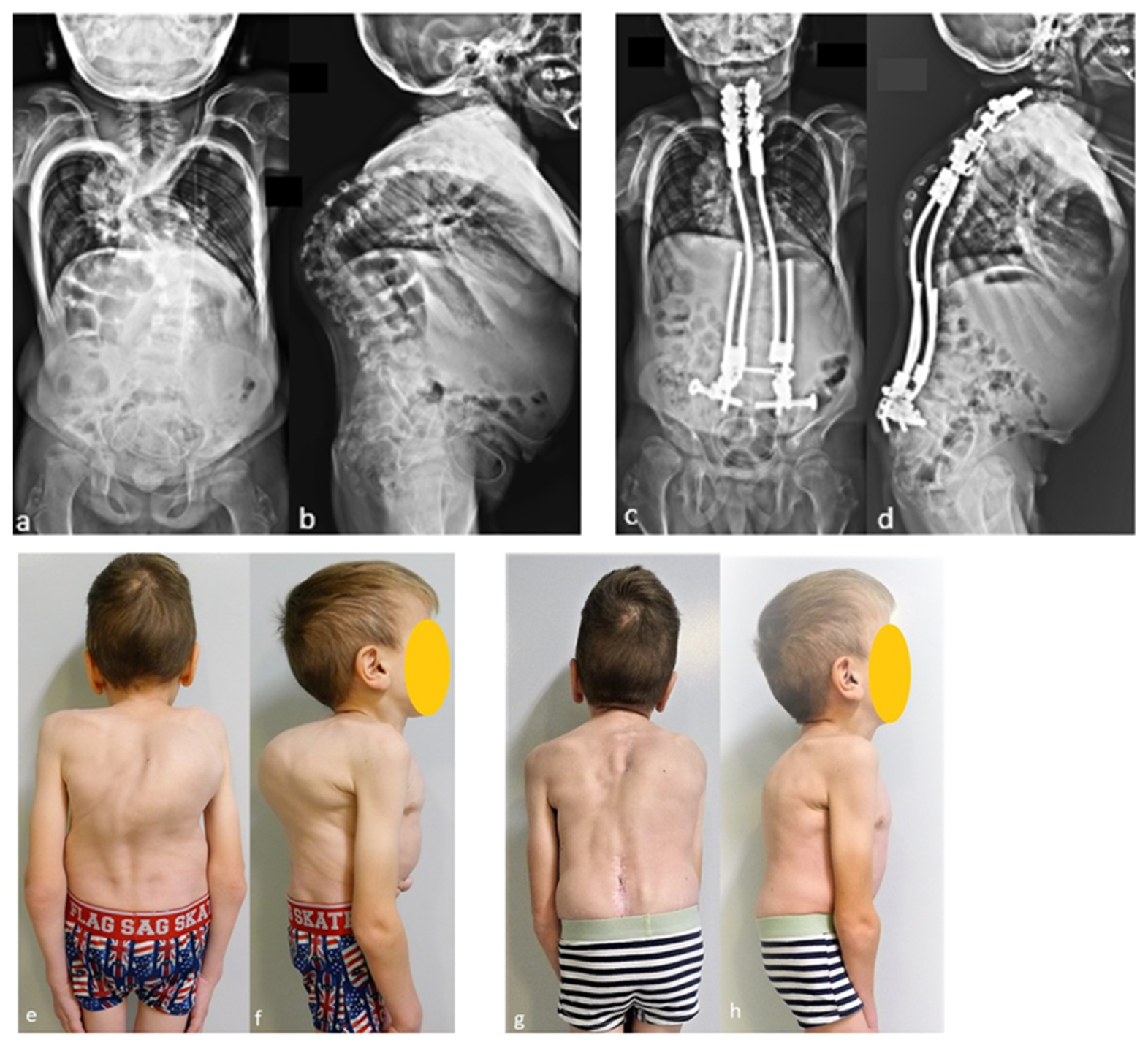 Children 11 00228 g001