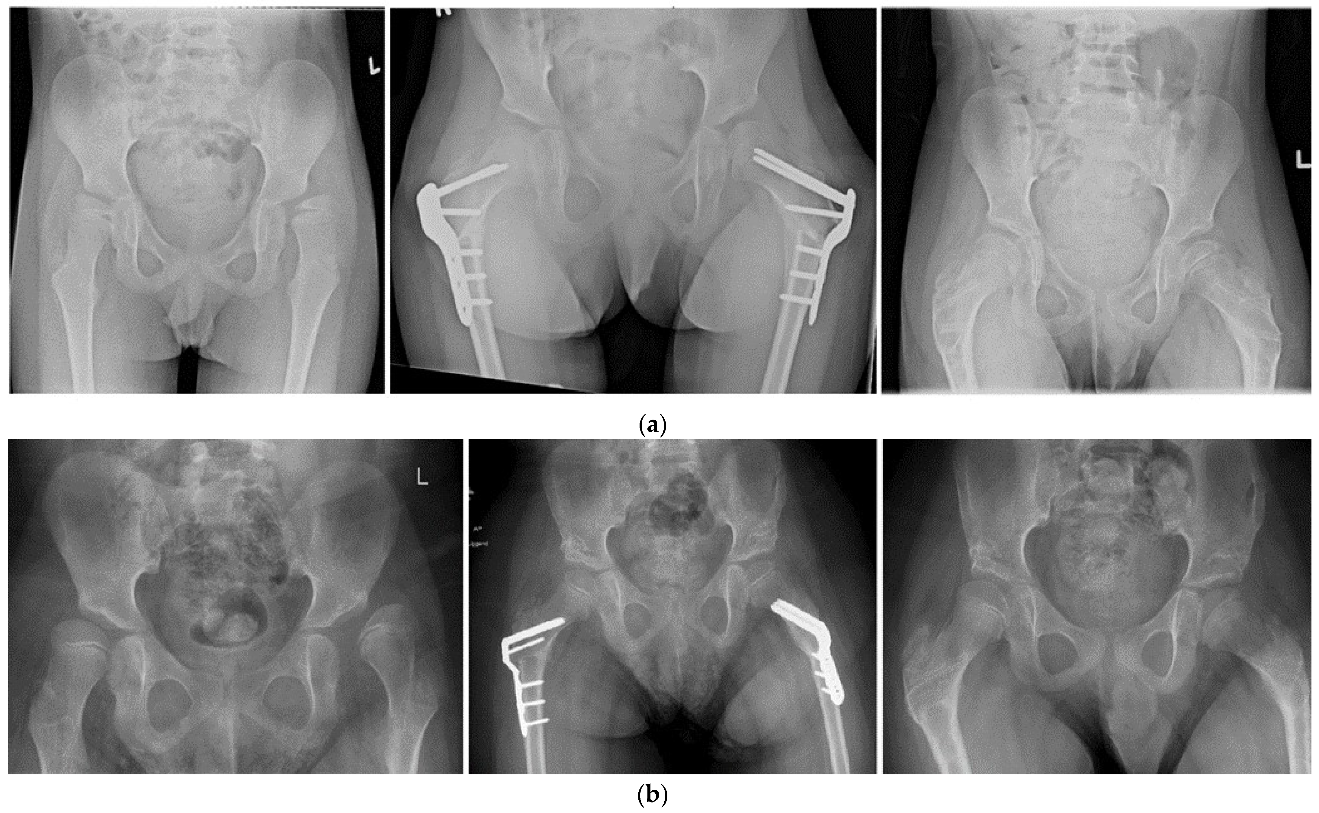 Children 11 00272 g002