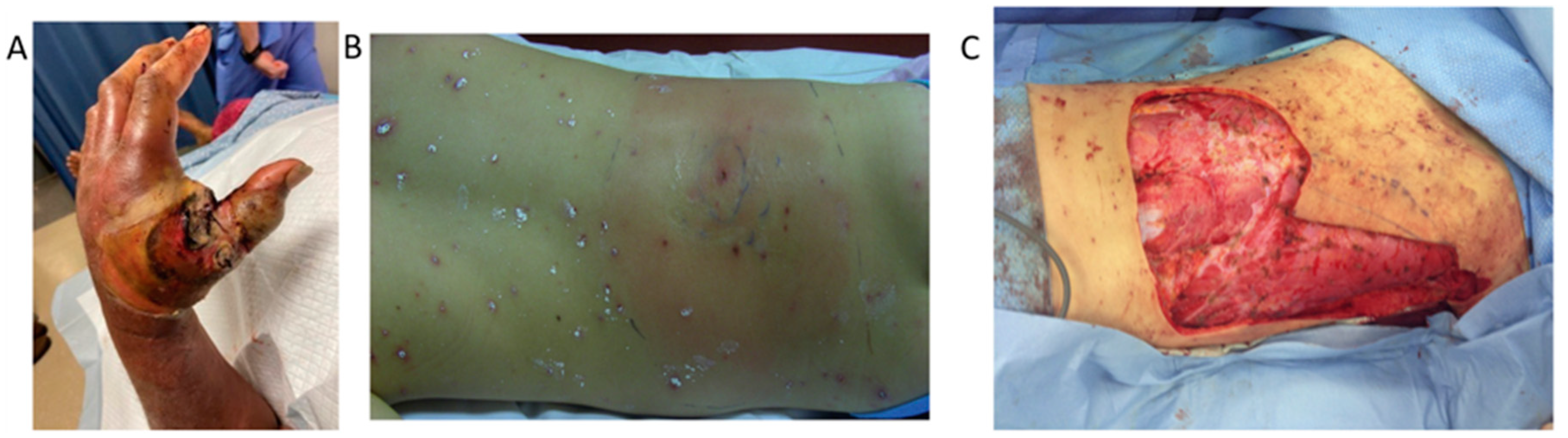 Children 11 00383 g001