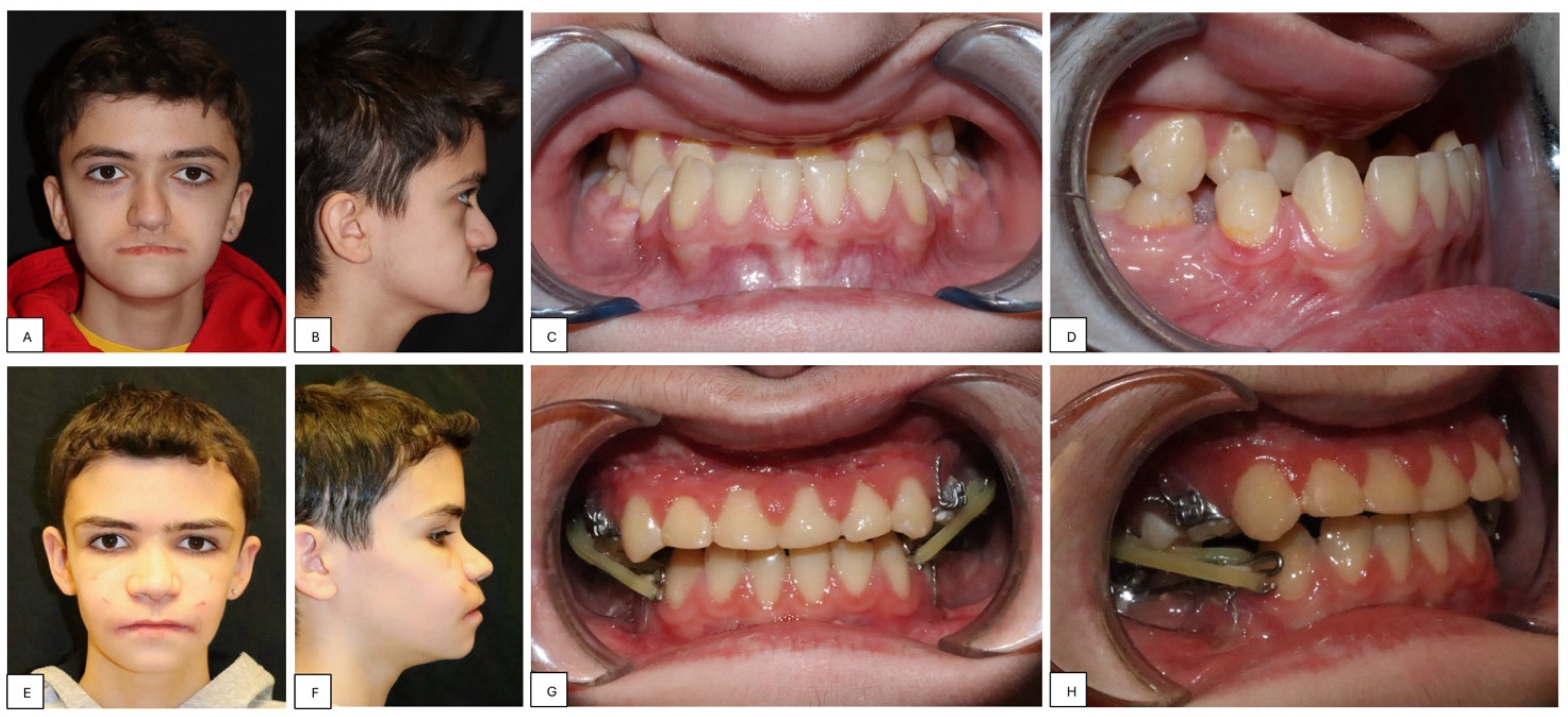 Children 11 00720 g001