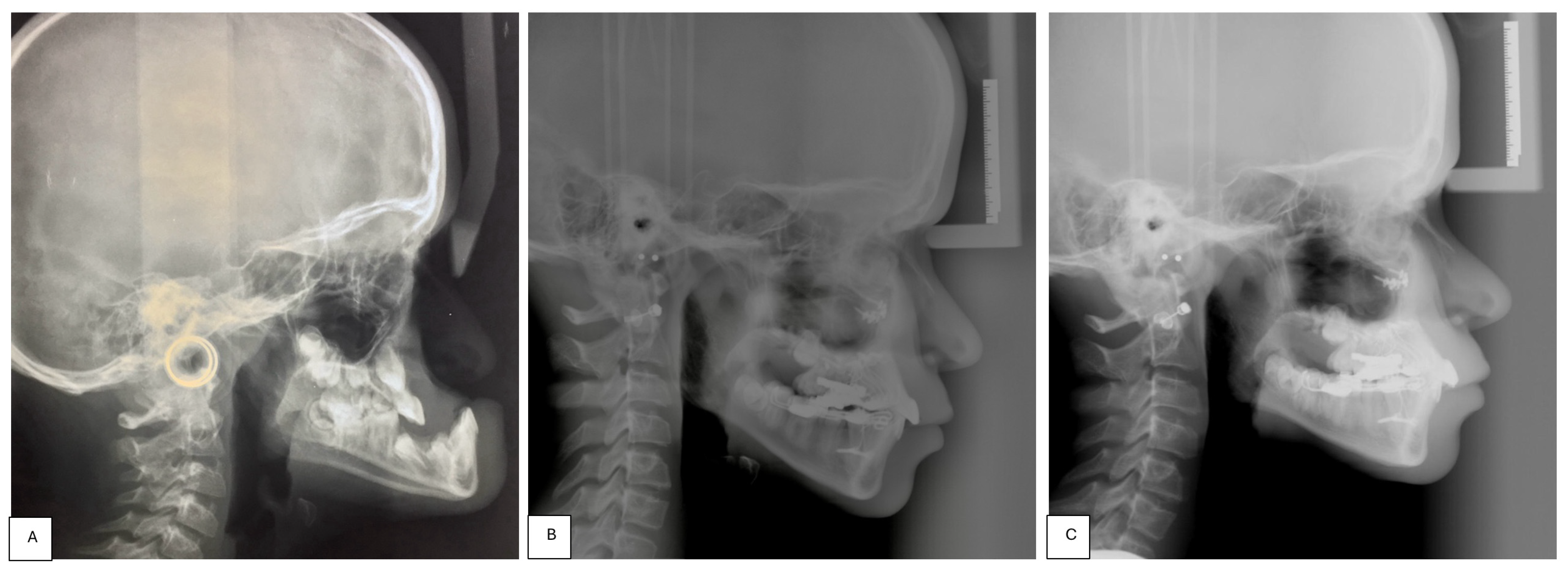 Children 11 00720 g002