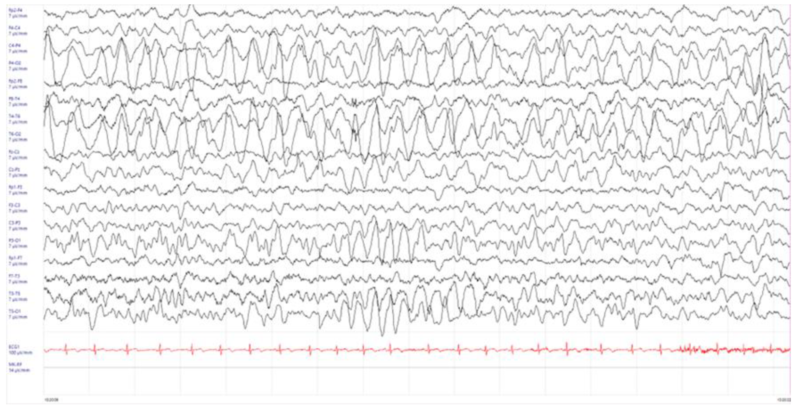 Children 11 00778 g001