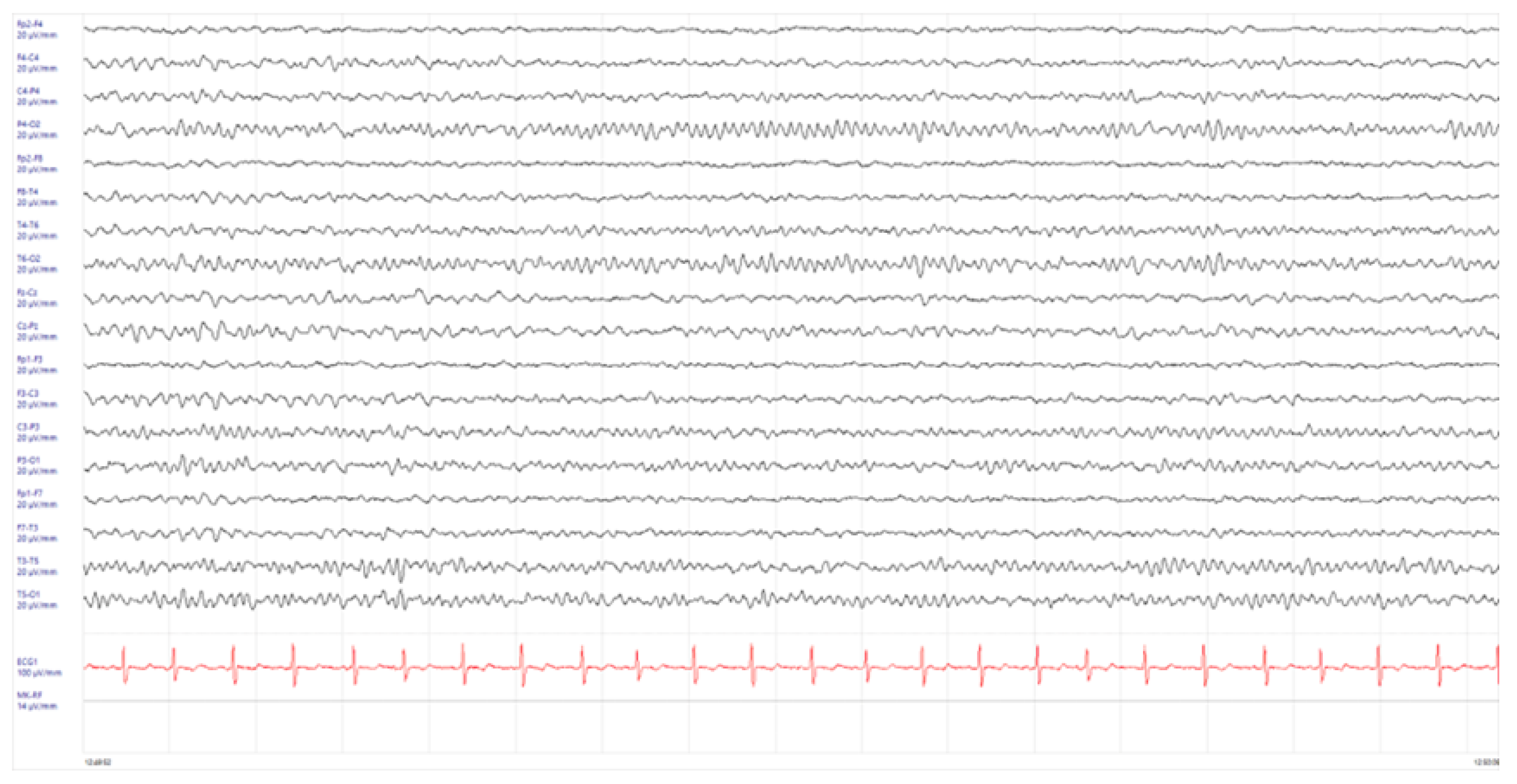 Children 11 00778 g004