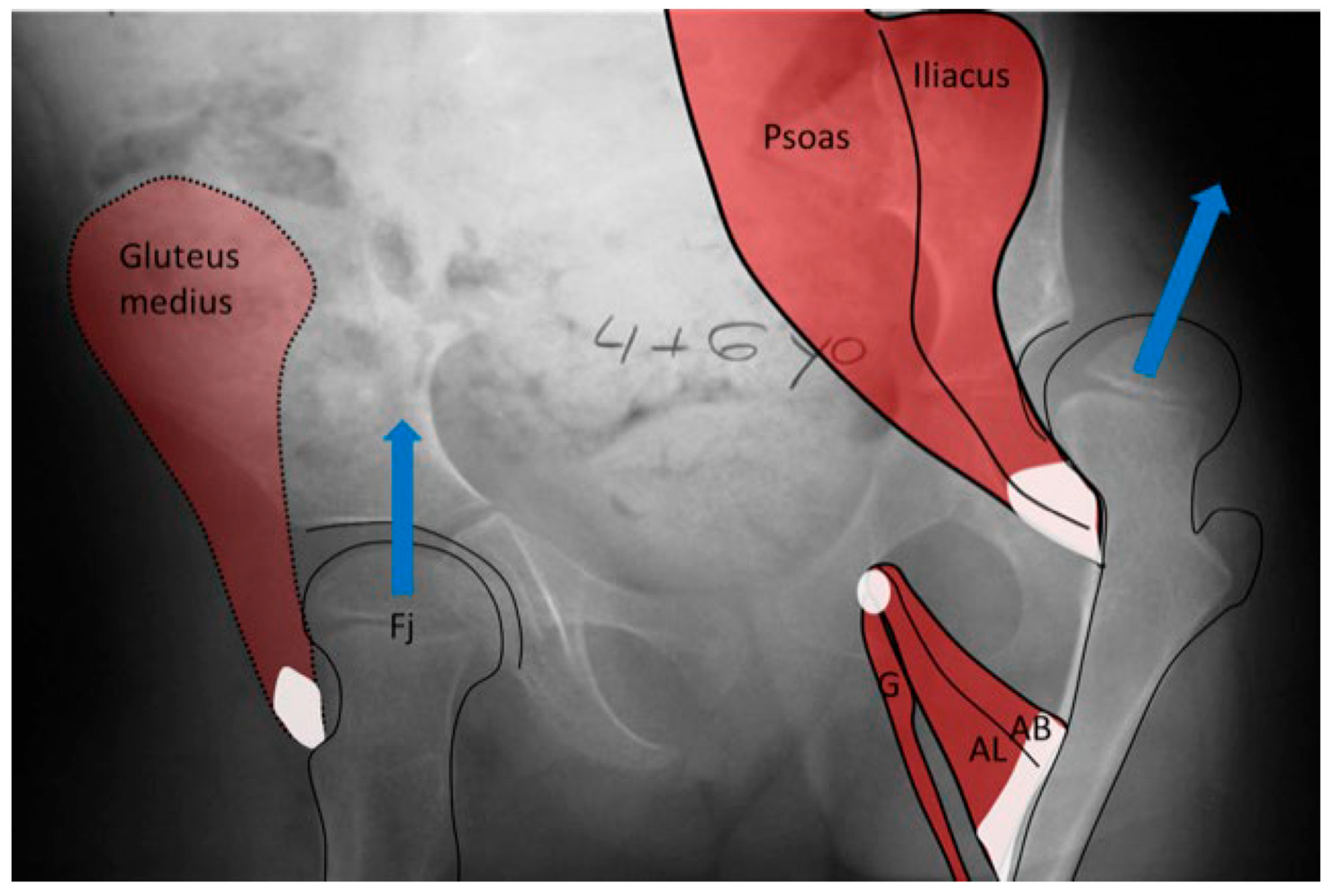 Children 11 00844 g009 Children 11 00844 g009