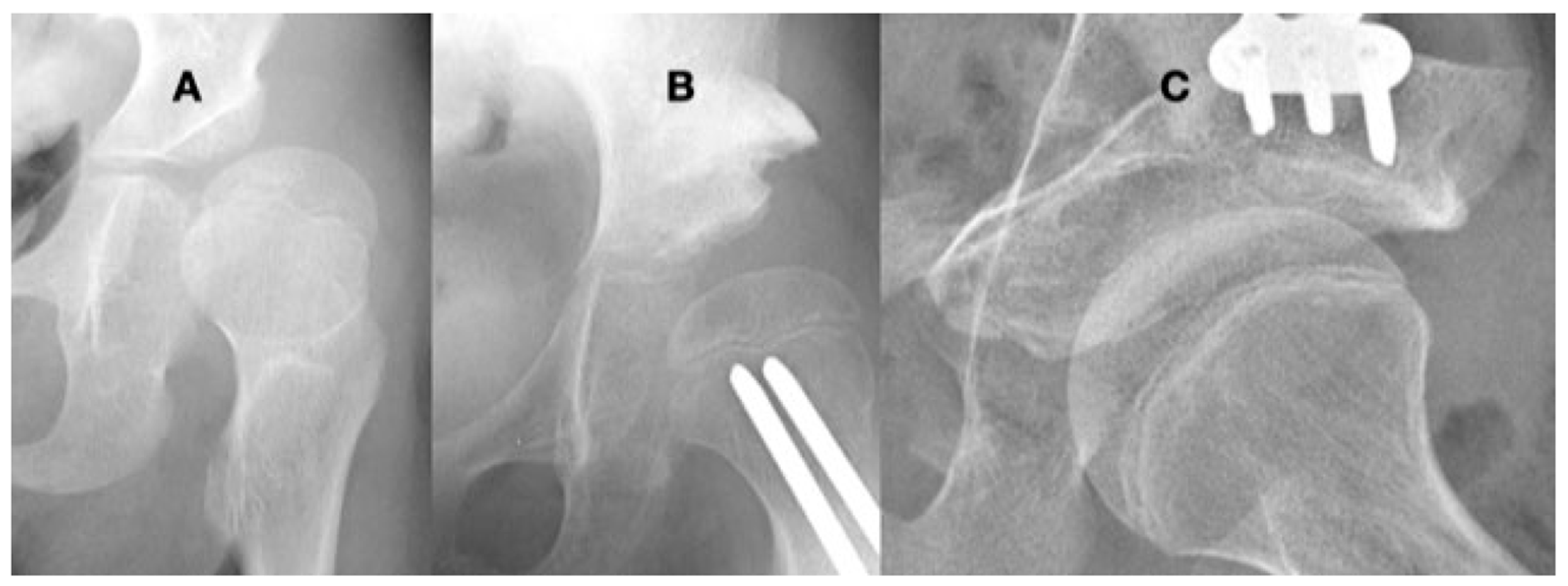 Children 11 00844 g010 Children 11 00844 g010