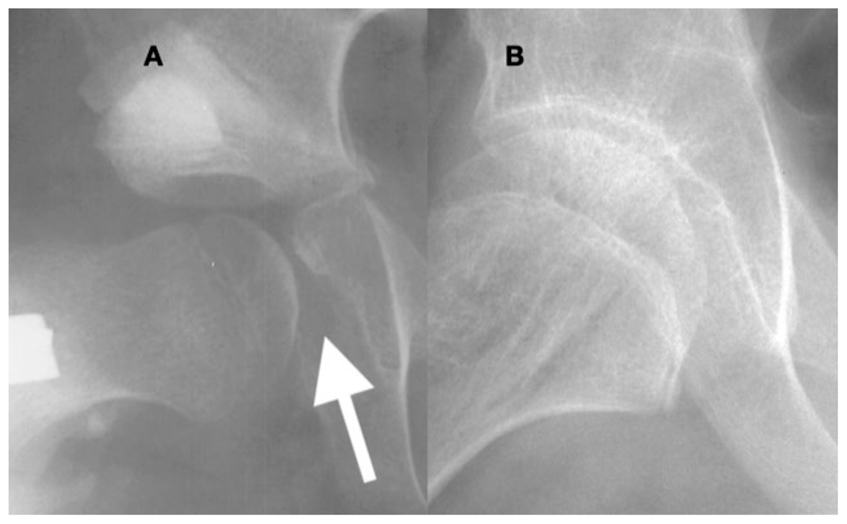 Children 11 00844 g013 Children 11 00844 g013