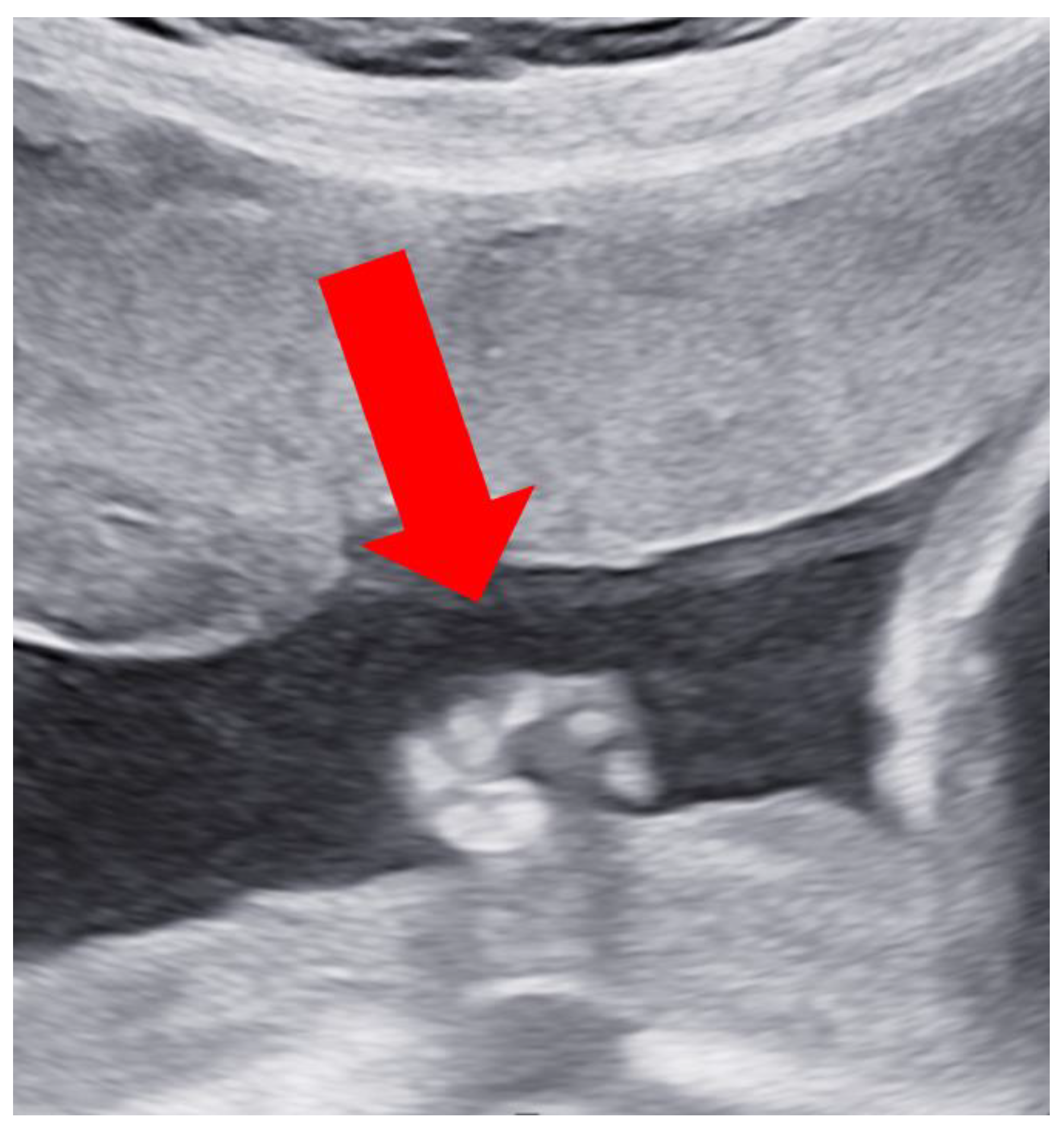 Children 11 00861 g004