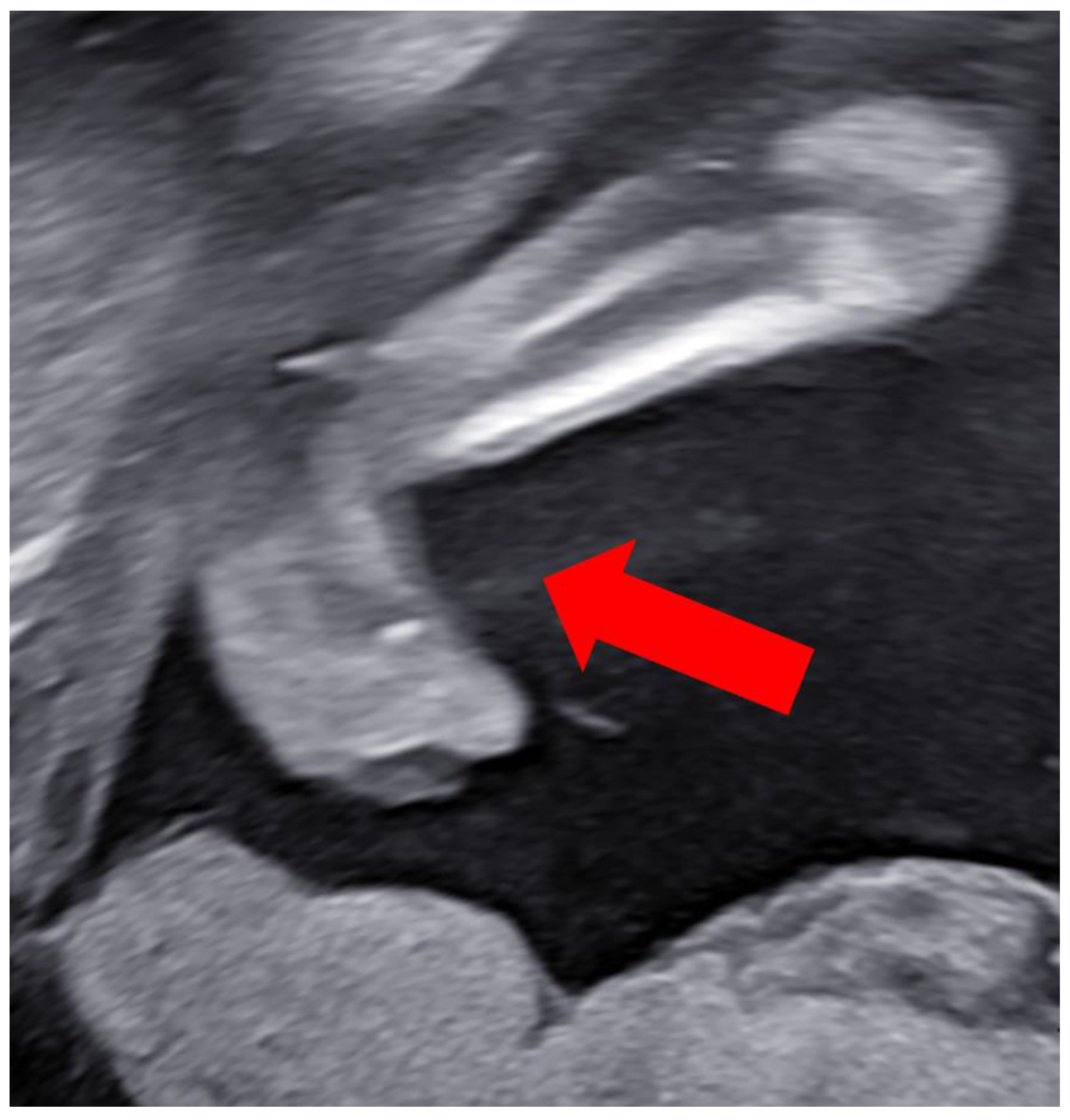 Children 11 00861 g005