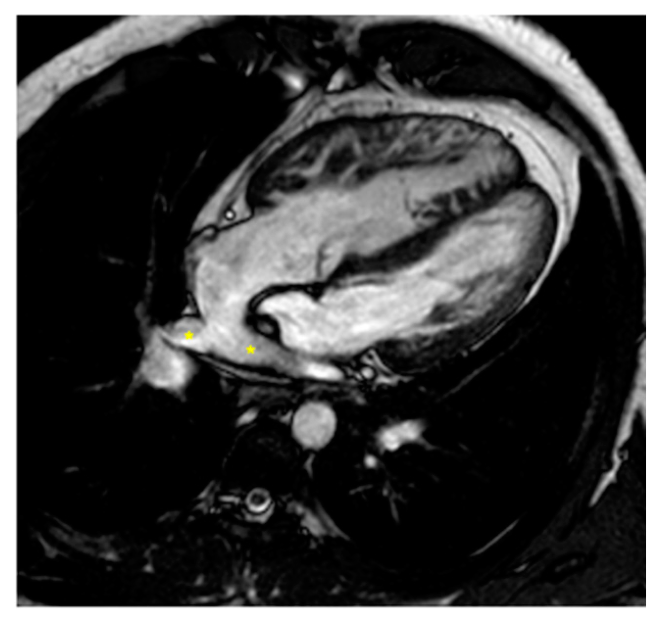 Children 11 00878 g002