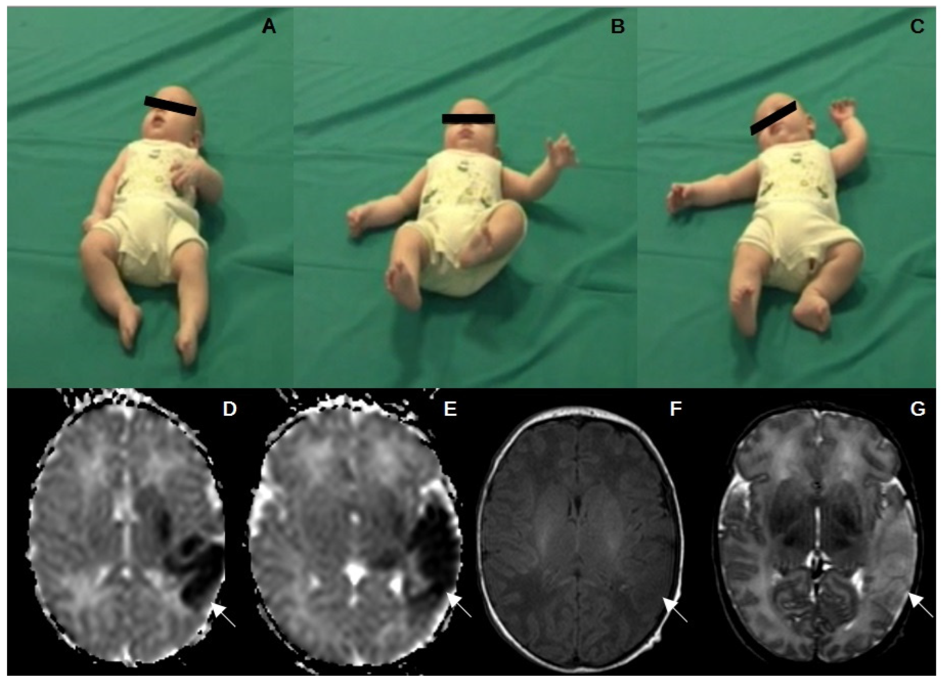 Children 11 00940 g001