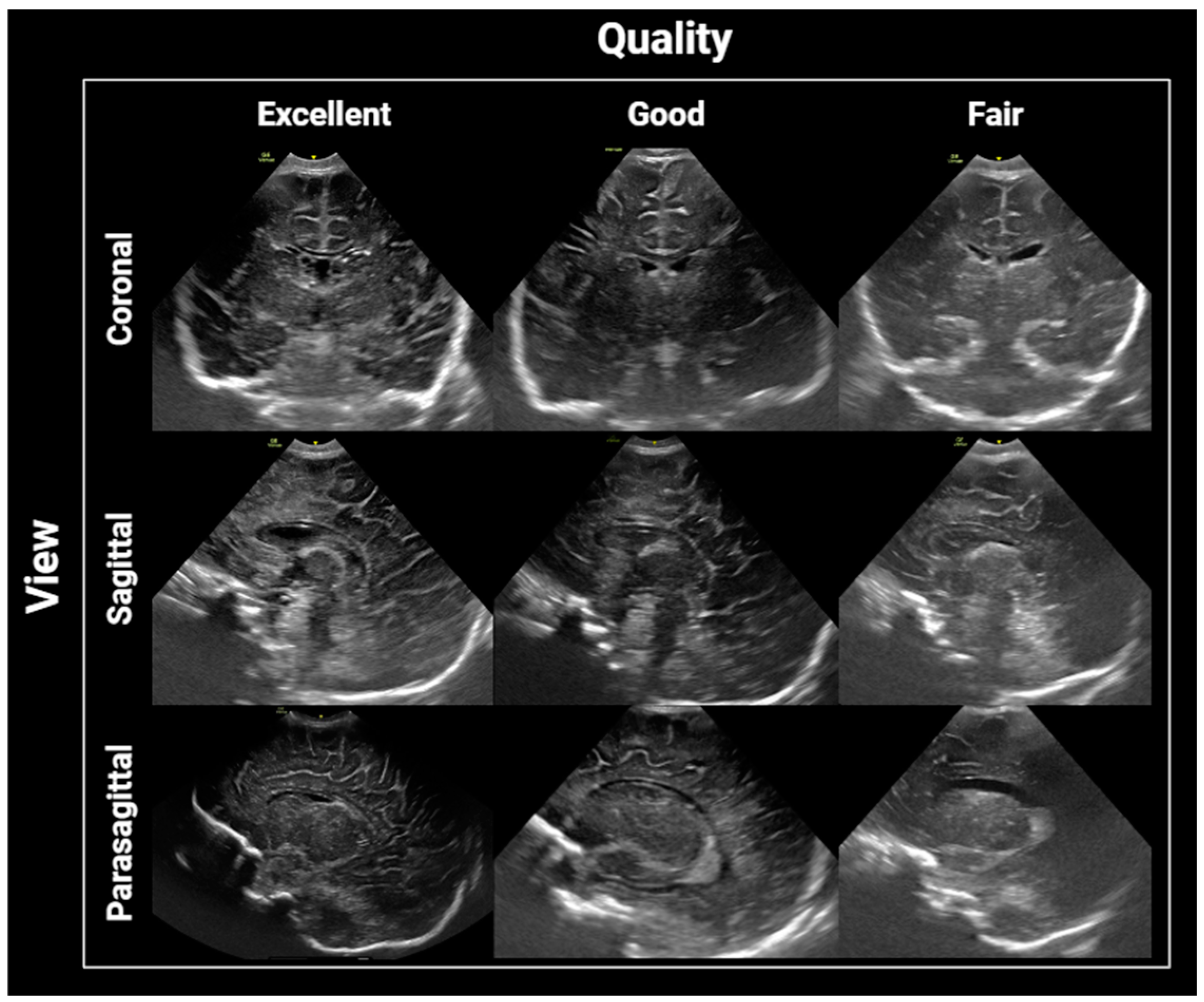 Children 11 01039 g001