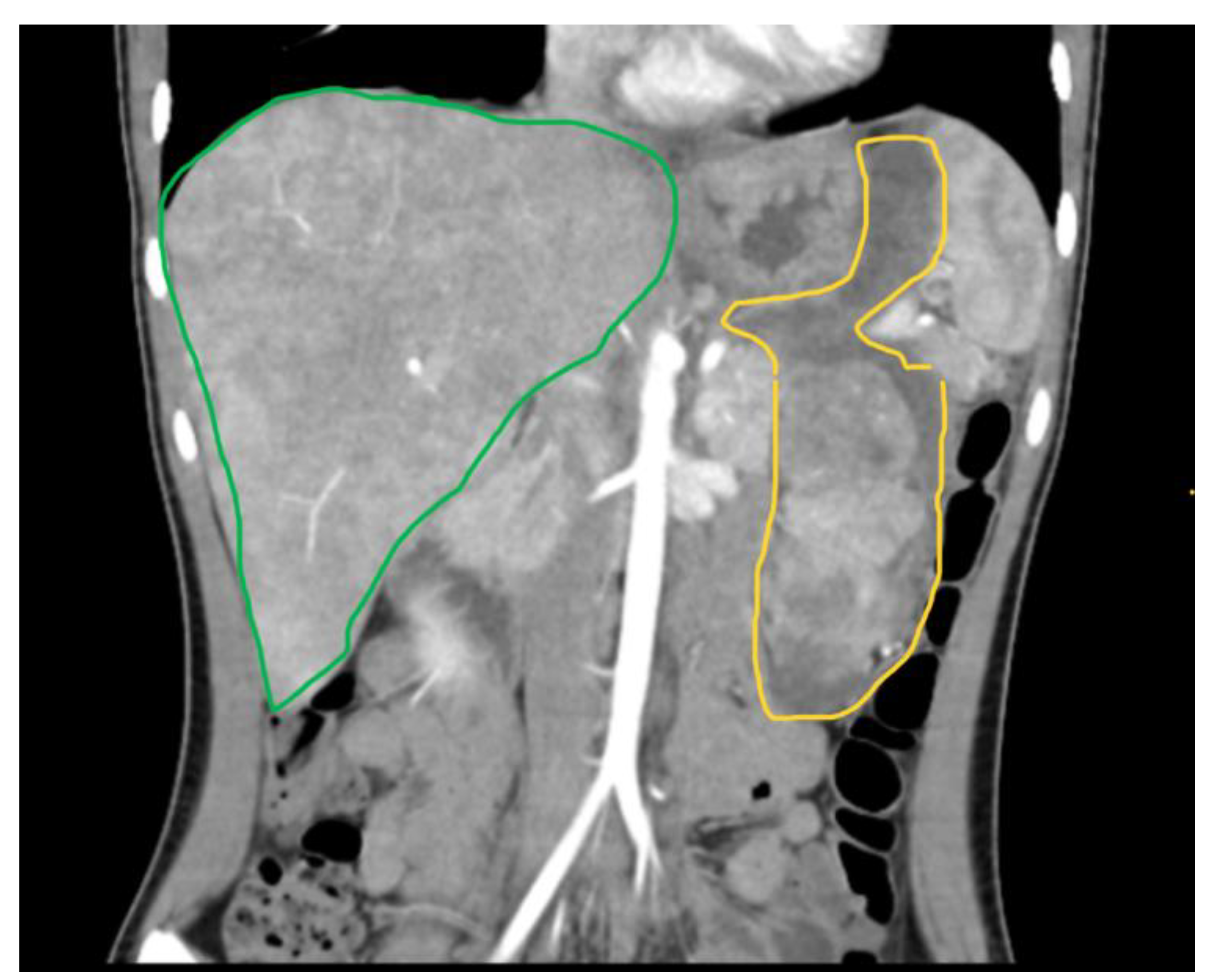 Children 11 01040 g006