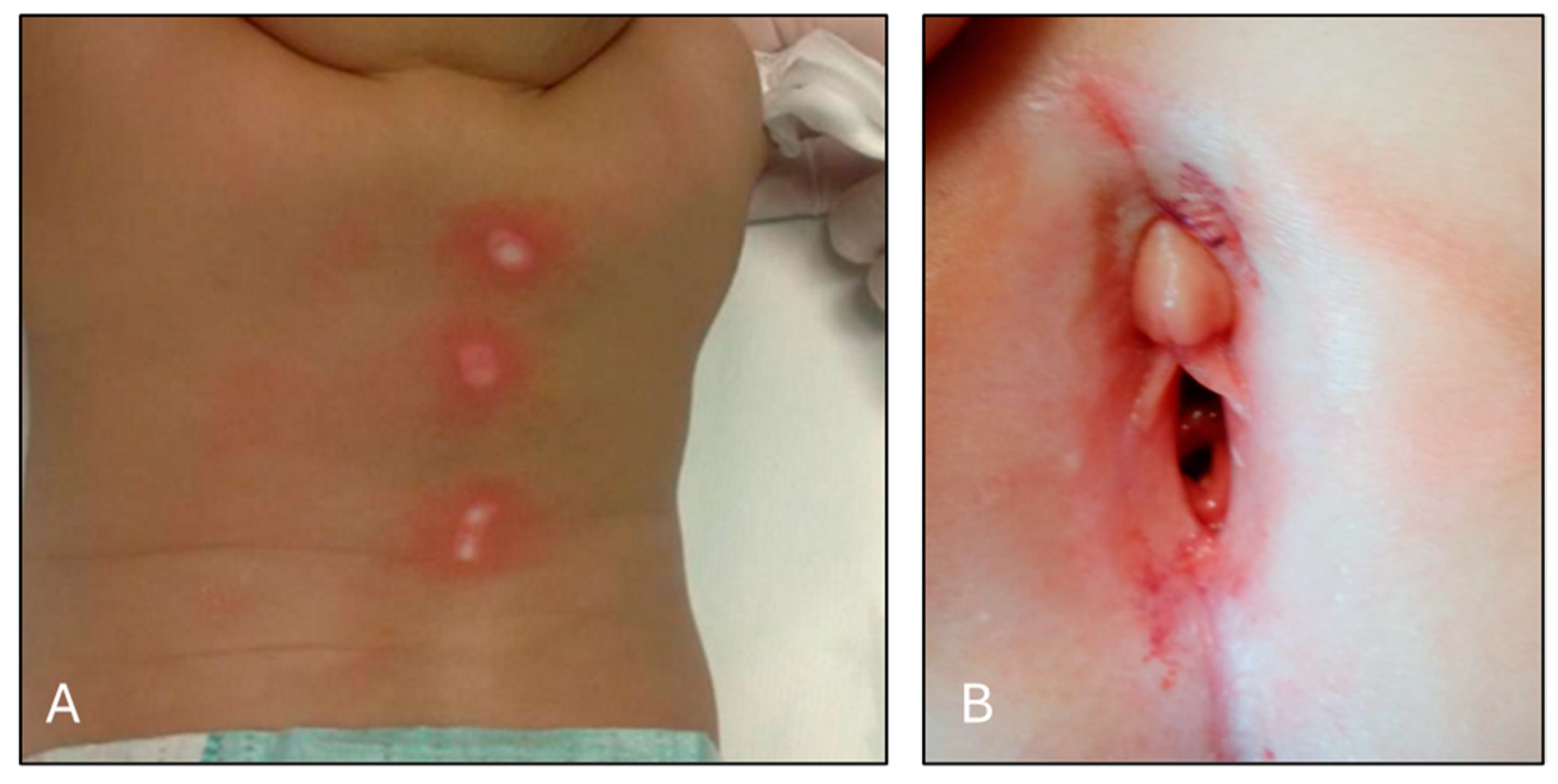 Children 11 01103 g002