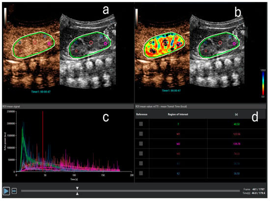 Contrast Enhanced Ultrasound CEUS and Ultra Microangiography  