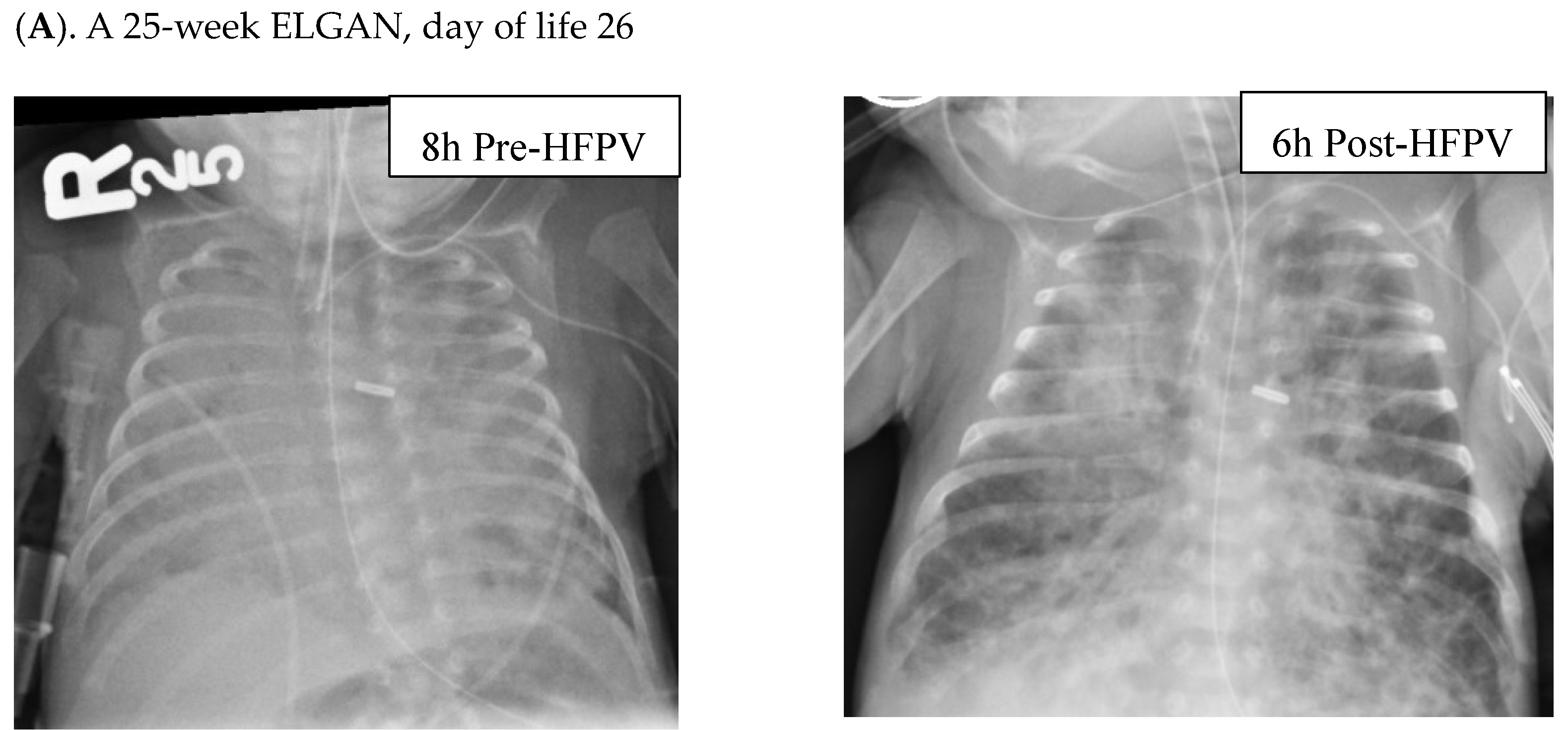 Children 11 01239 g002a