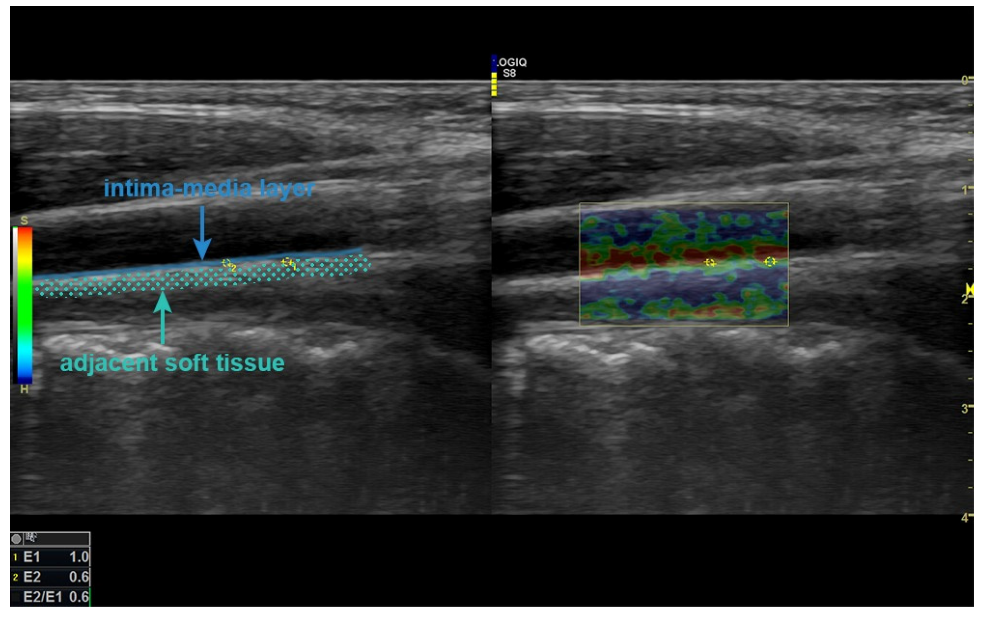 Children 12 00232 g001 Children 12 00232 g001