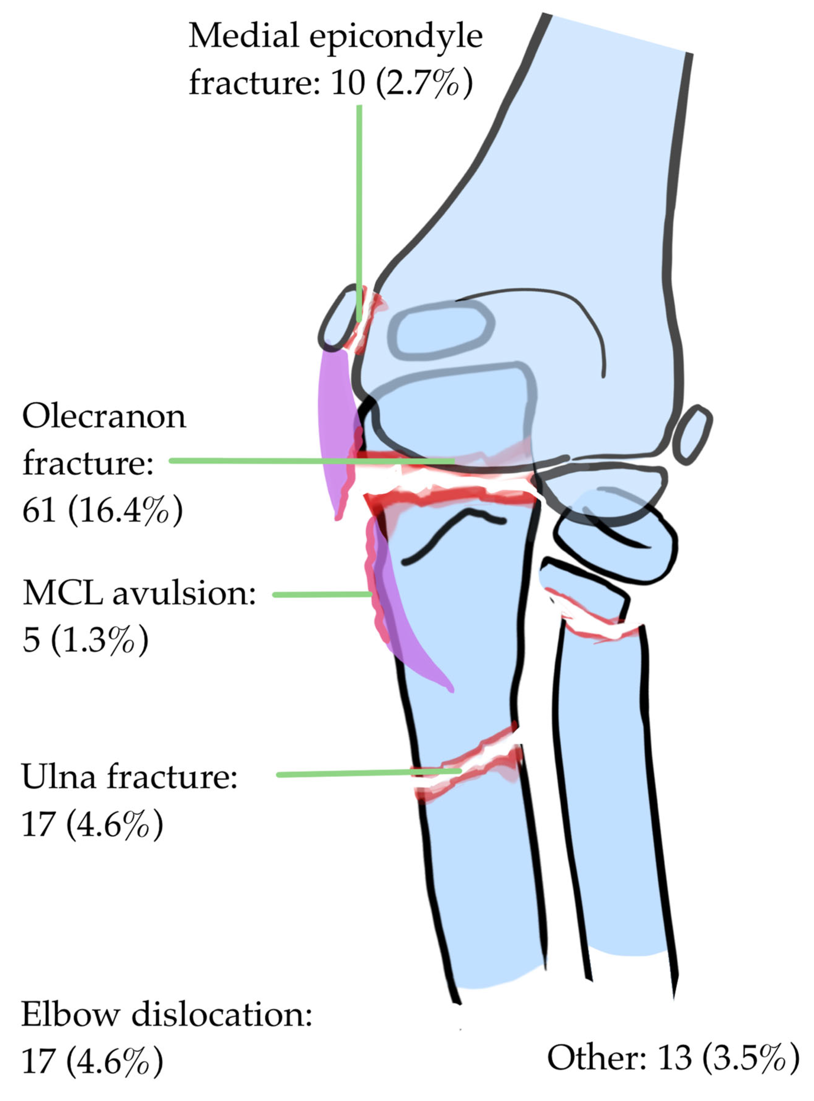 Children 12 00300 g002 Children 12 00300 g002