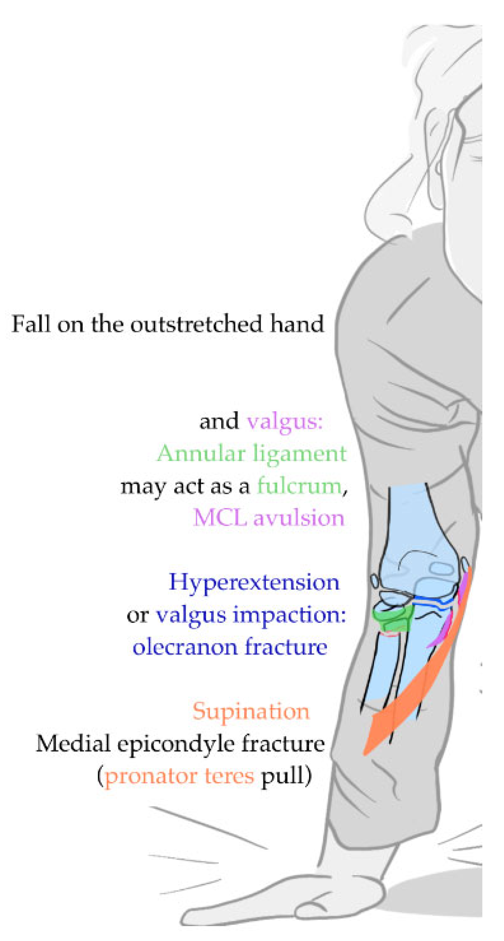 Children 12 00300 g007 Children 12 00300 g007