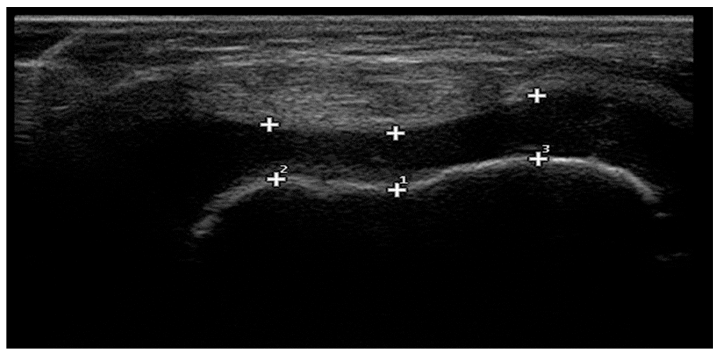 Children 12 01021 g001