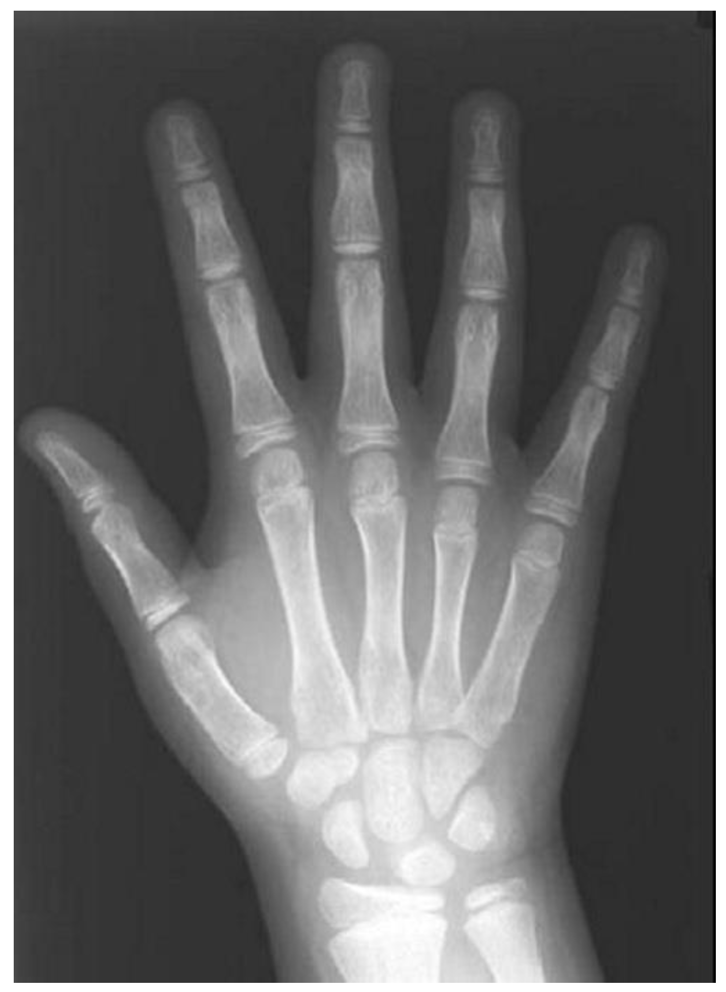 Children 12 01023 g007 Children 12 01023 g007