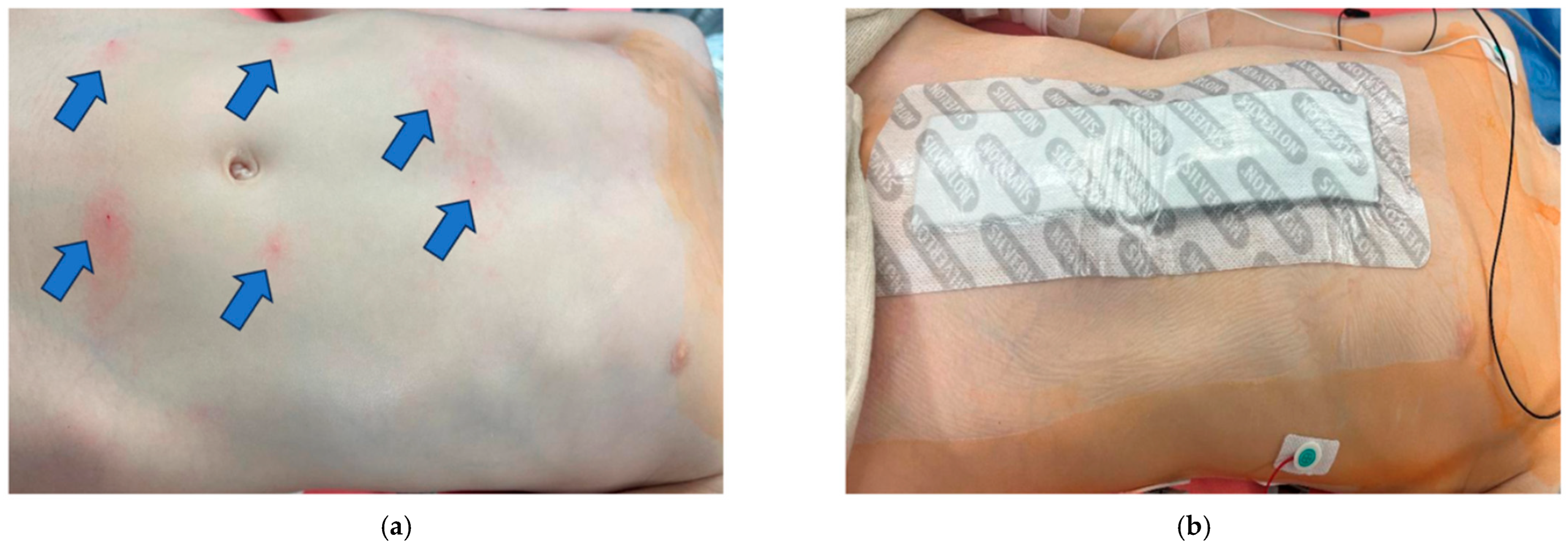 Children 12 01450 g002 Children 12 01450 g002