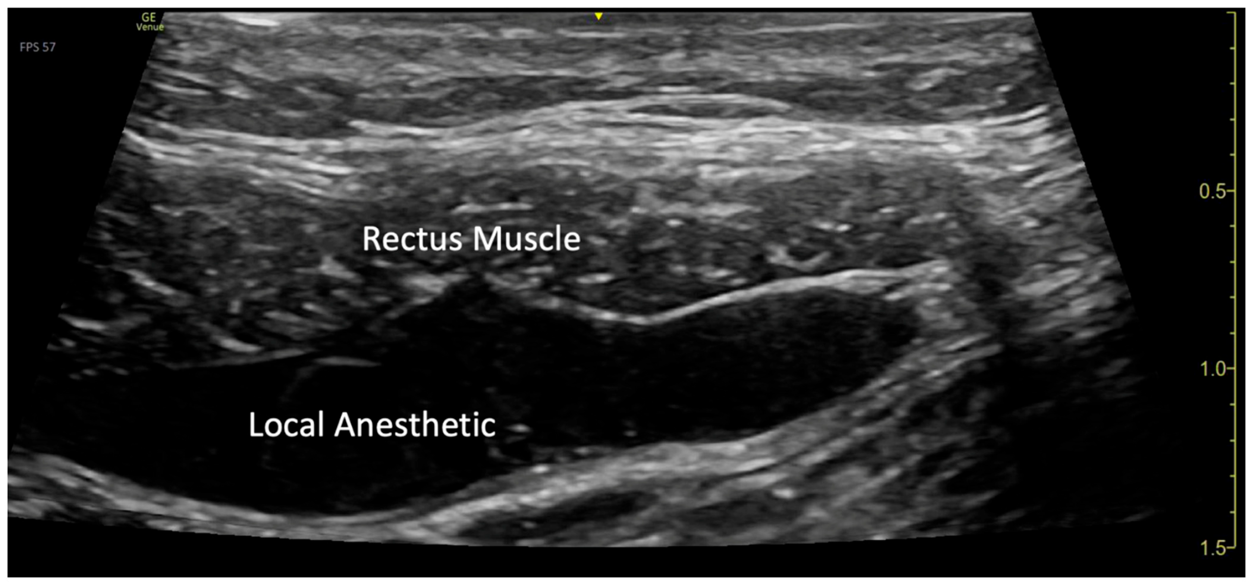 Children 12 01450 g003 Children 12 01450 g003