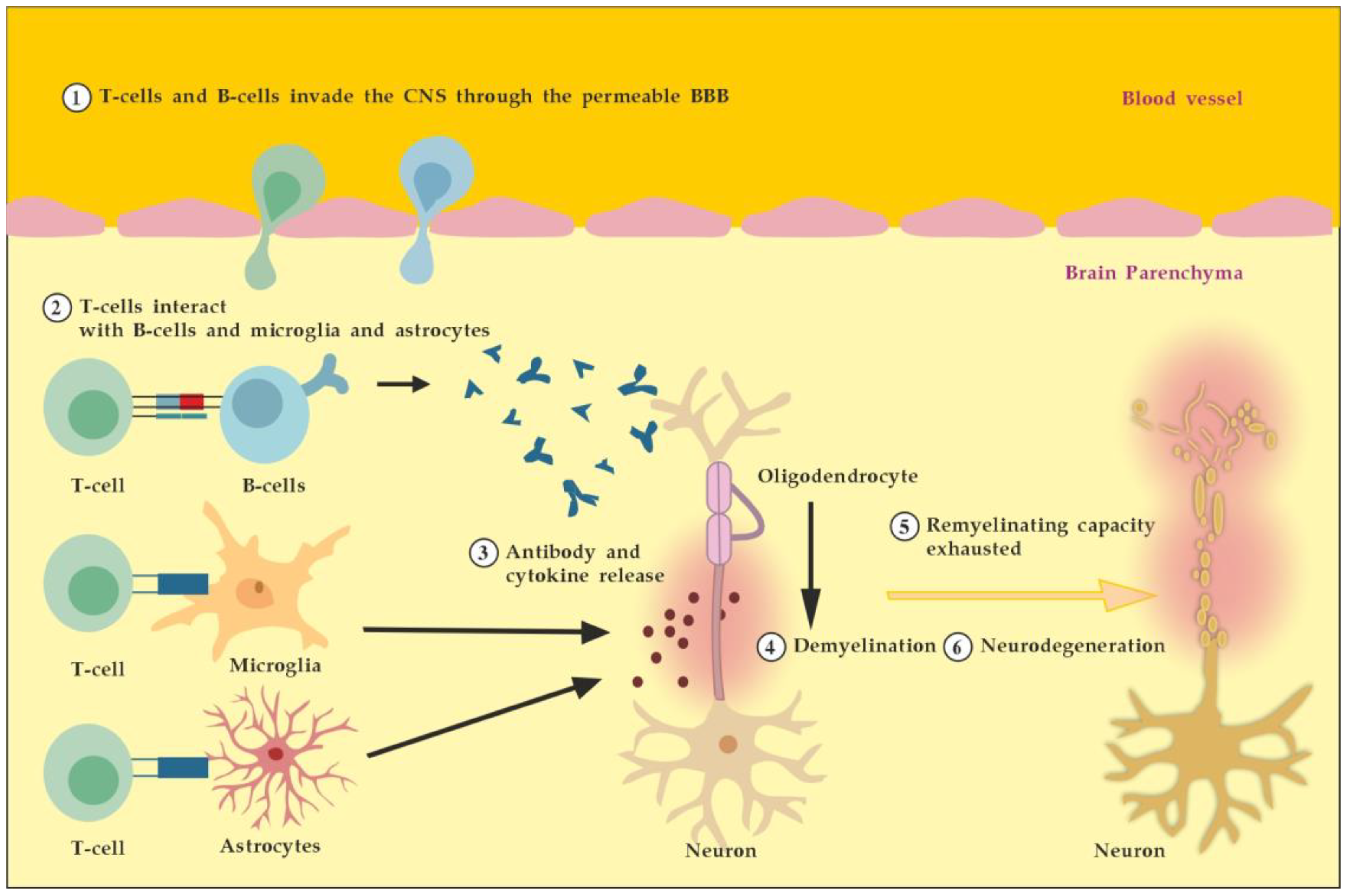 CIMB | Free Full-Text | Therapeutic Plasma Exchange and Multiple