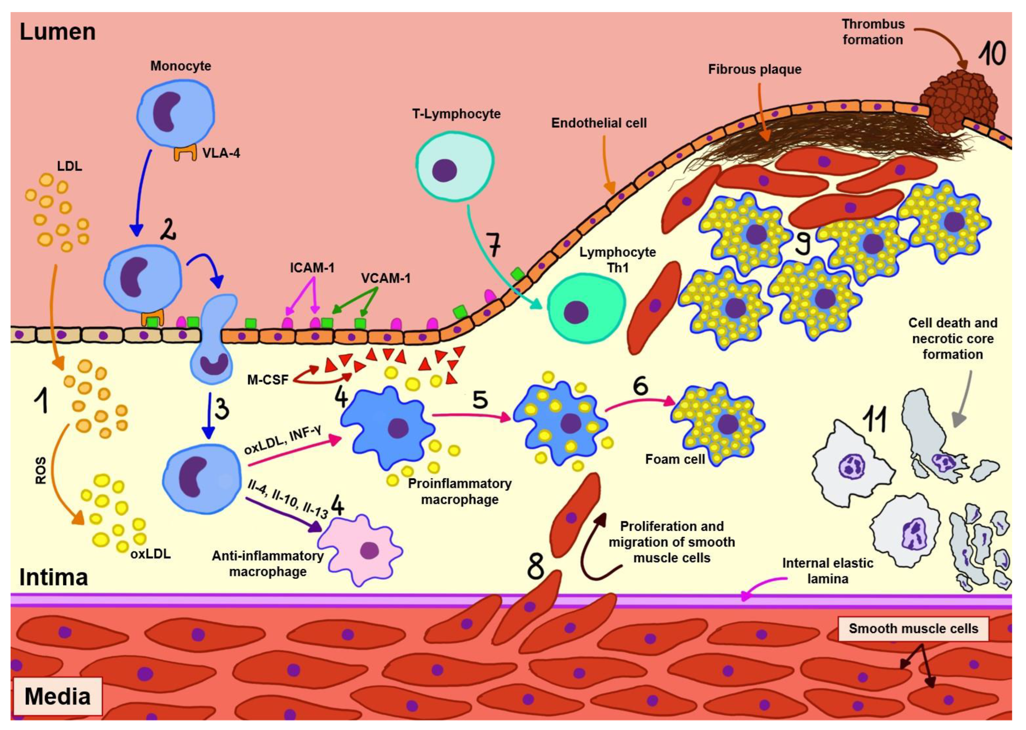 CIMB | Free Full-Text | Molecular Linkage between Immune System Disorders  and Atherosclerosis