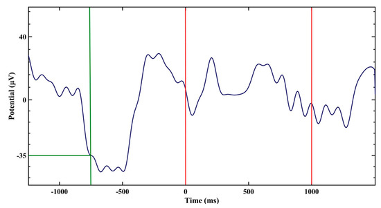 Clocks Sleep Free Full Text Effectiveness of Visual vs