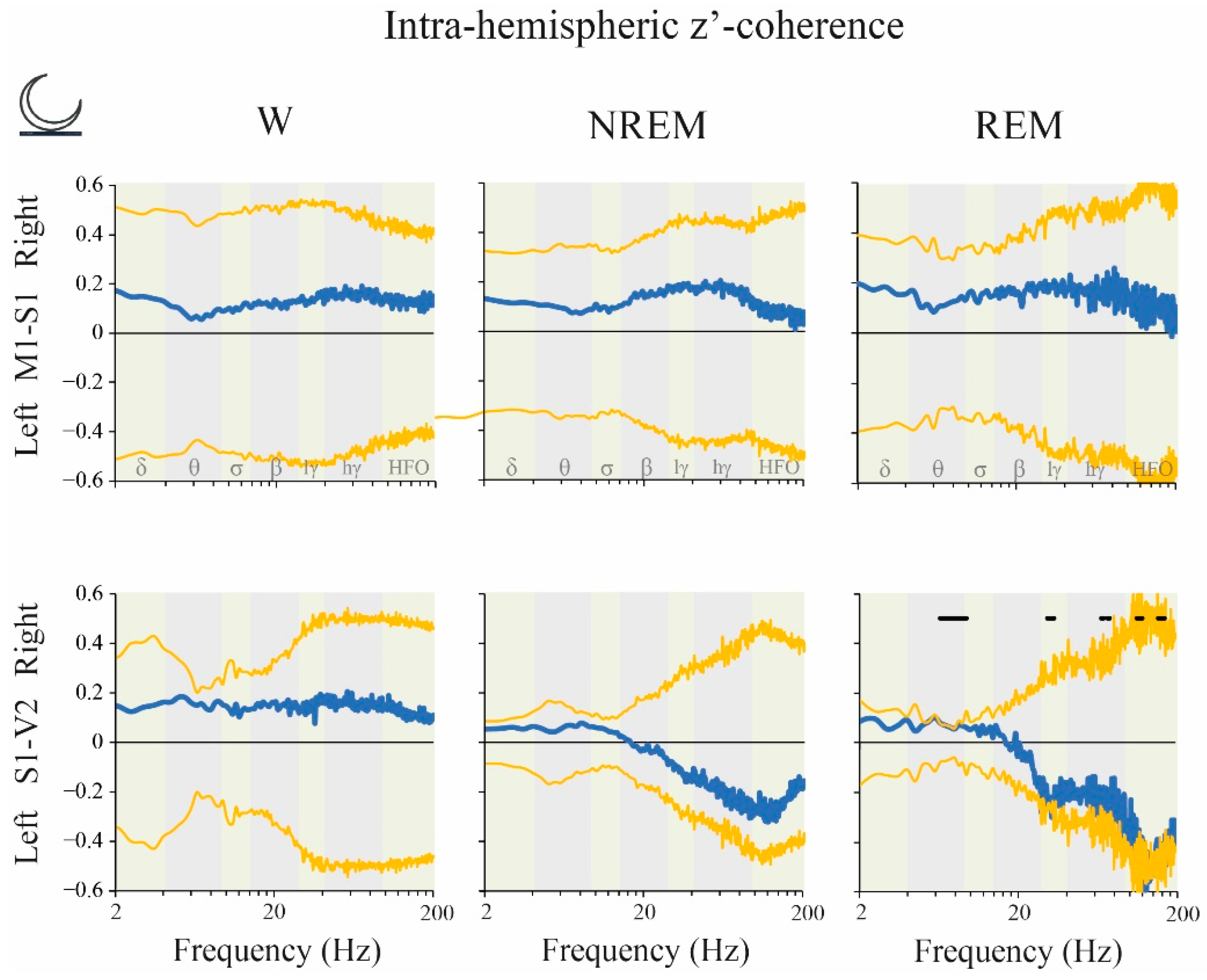 Clockssleep 02 00039 g010 Clockssleep 02 00039 g010