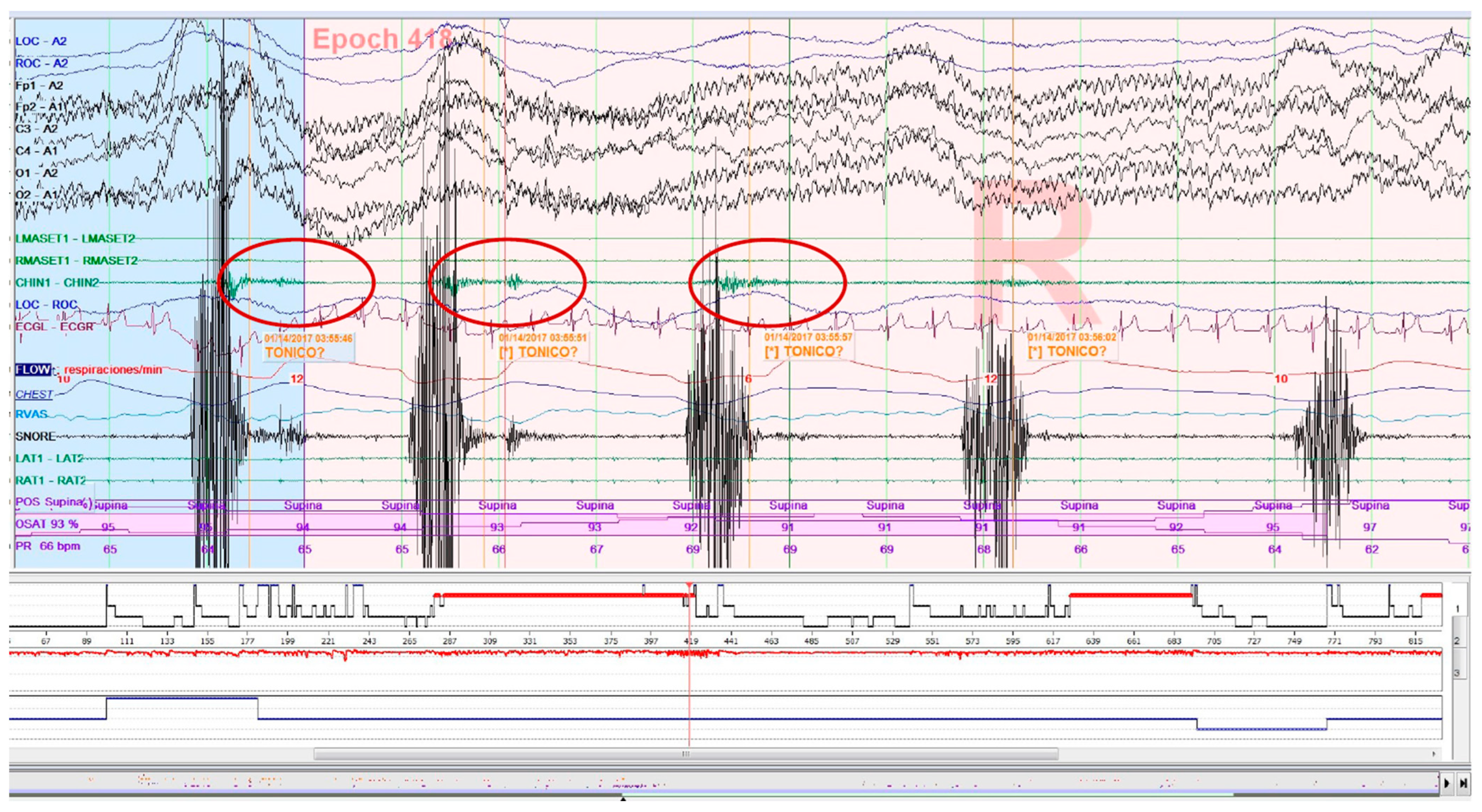 Clockssleep 05 00047 g003