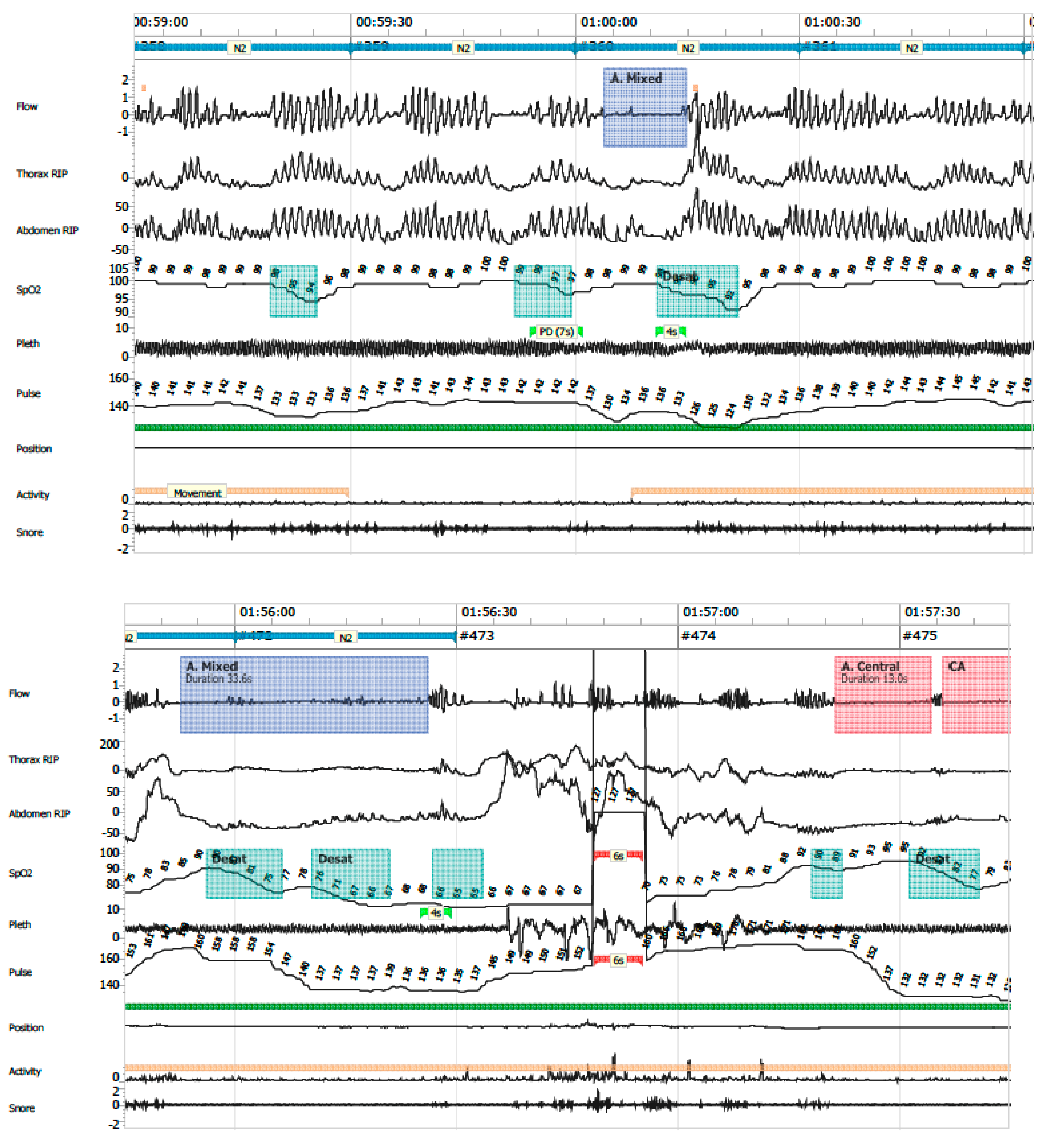 Clockssleep 07 00042 g007 Clockssleep 07 00042 g007