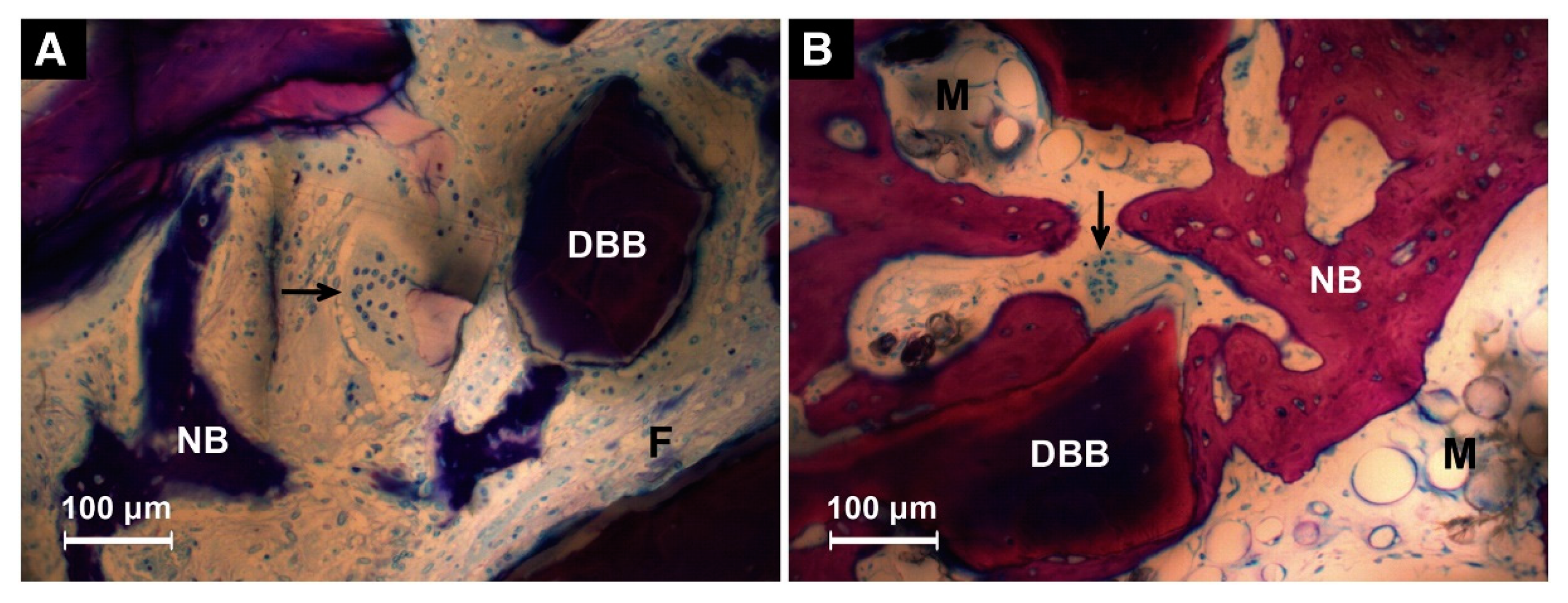 Coatings 10 01118 g004