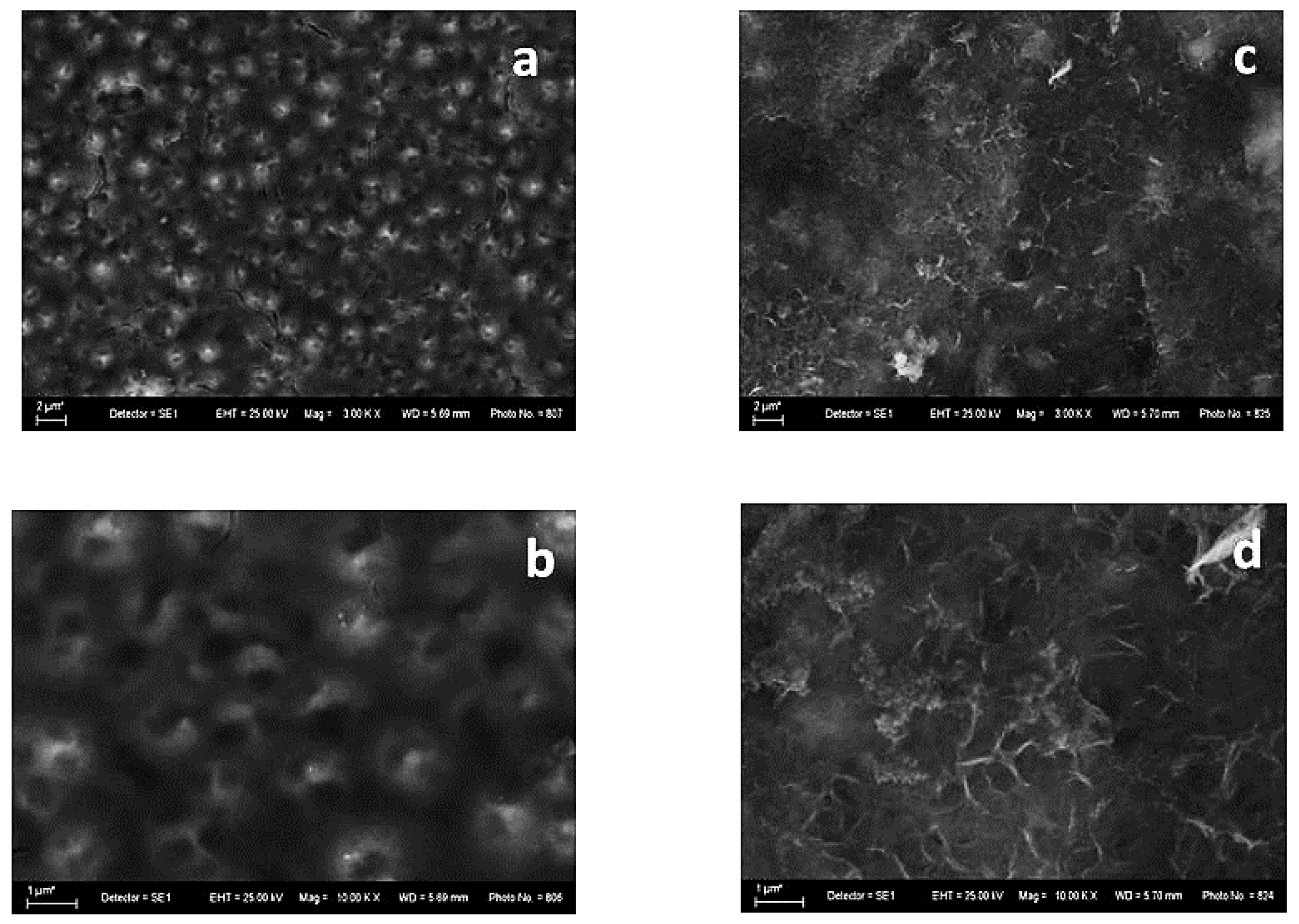 Micrographs of low, medium and high carbon steel a, e, i Untreated, b