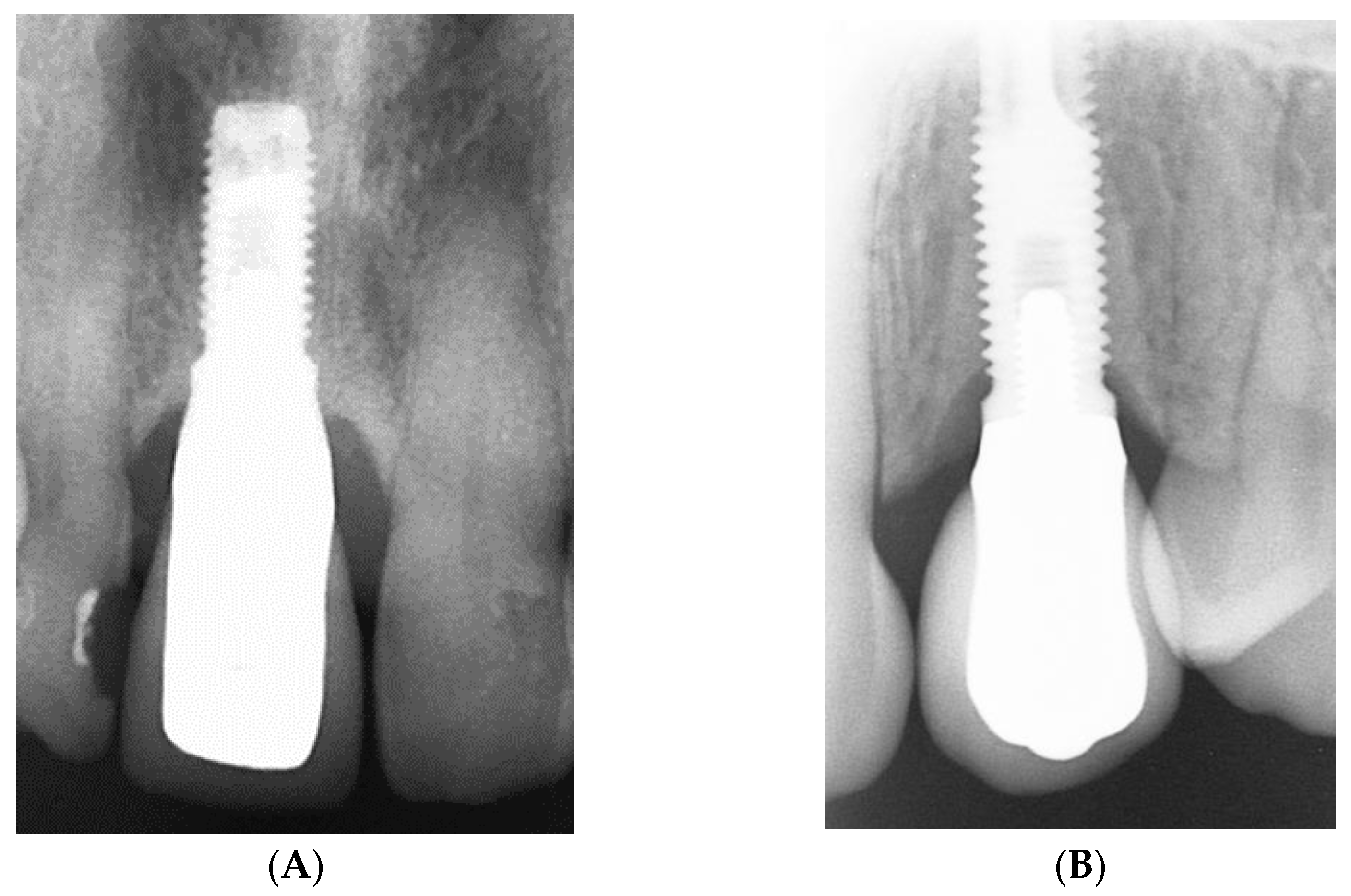 Coatings 13 01976 g011 Coatings 13 01976 g011